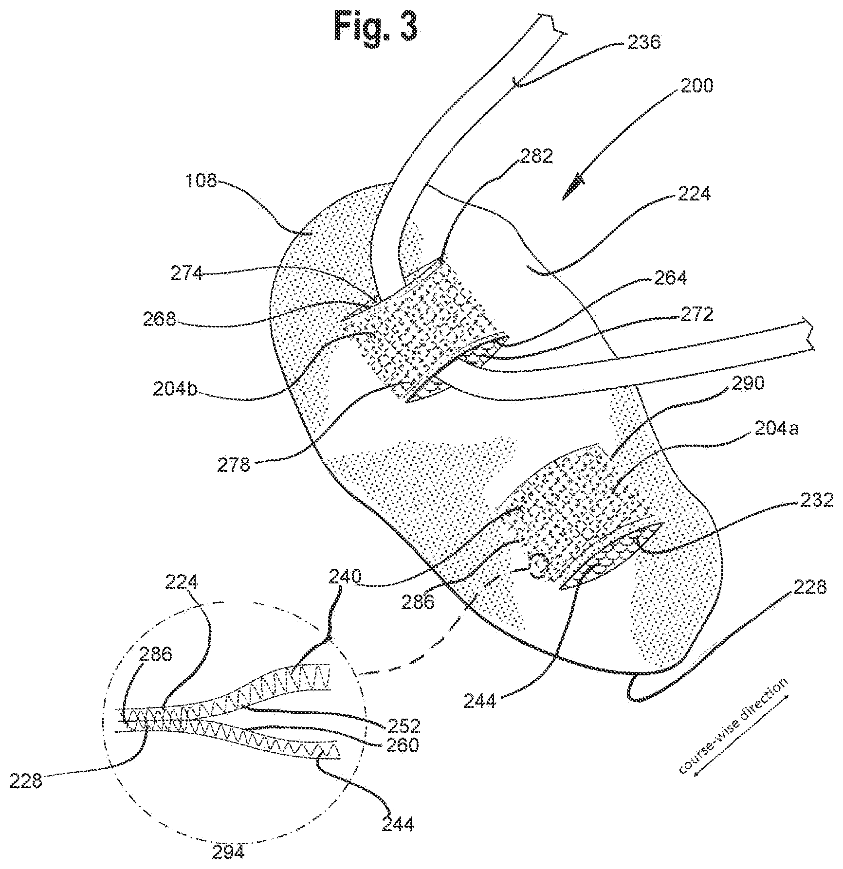 Patent US12129578 Figure 2 – Multiple layer knitted components having multi-bed area
