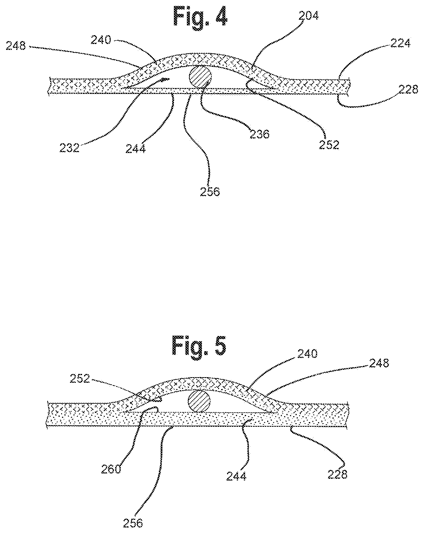 Patent US12129578 Figure 3 – Multiple layer knitted components having multi-bed area