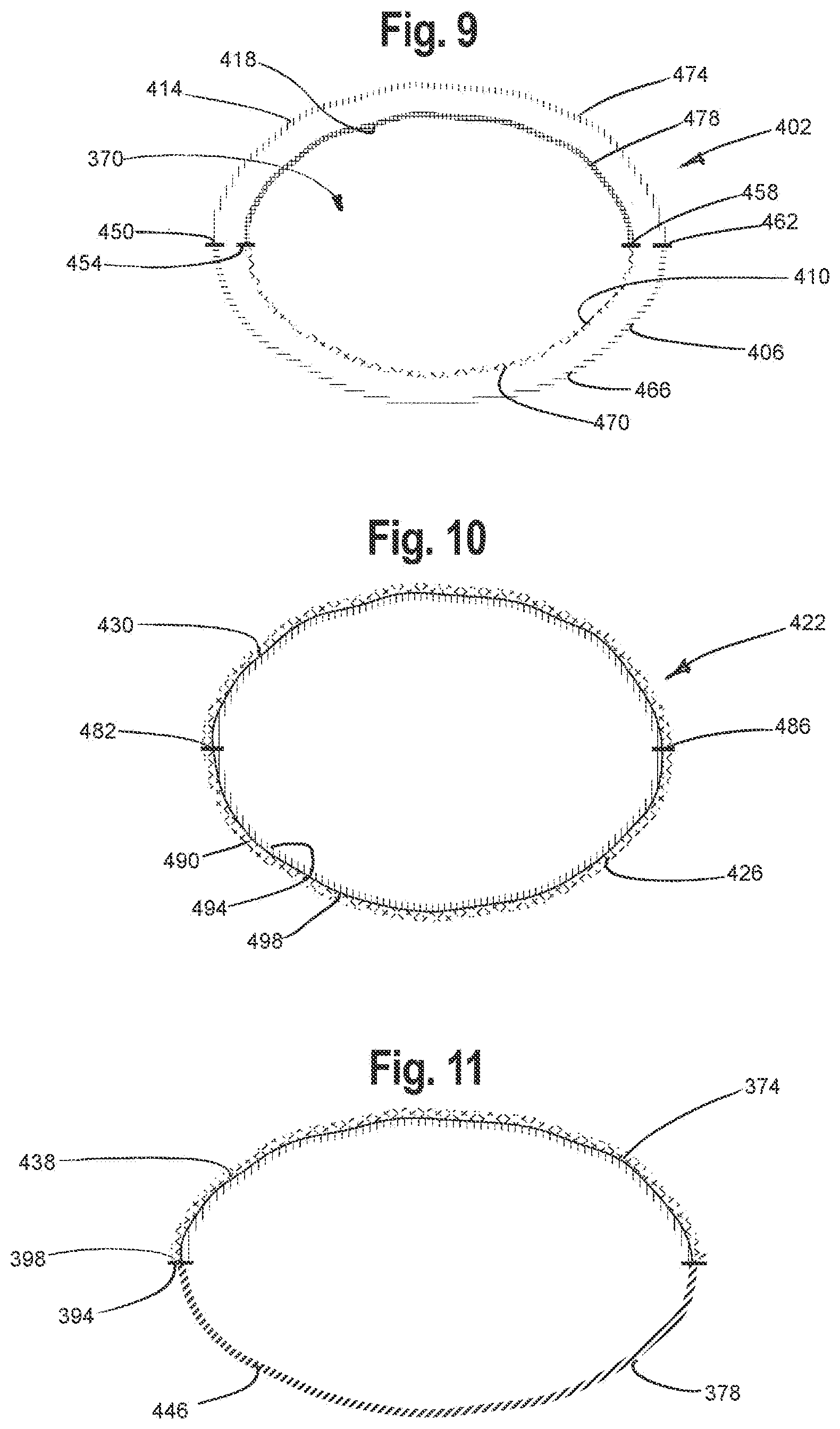 Patent US12129578 Figure 6 – Multiple layer knitted components having multi-bed area