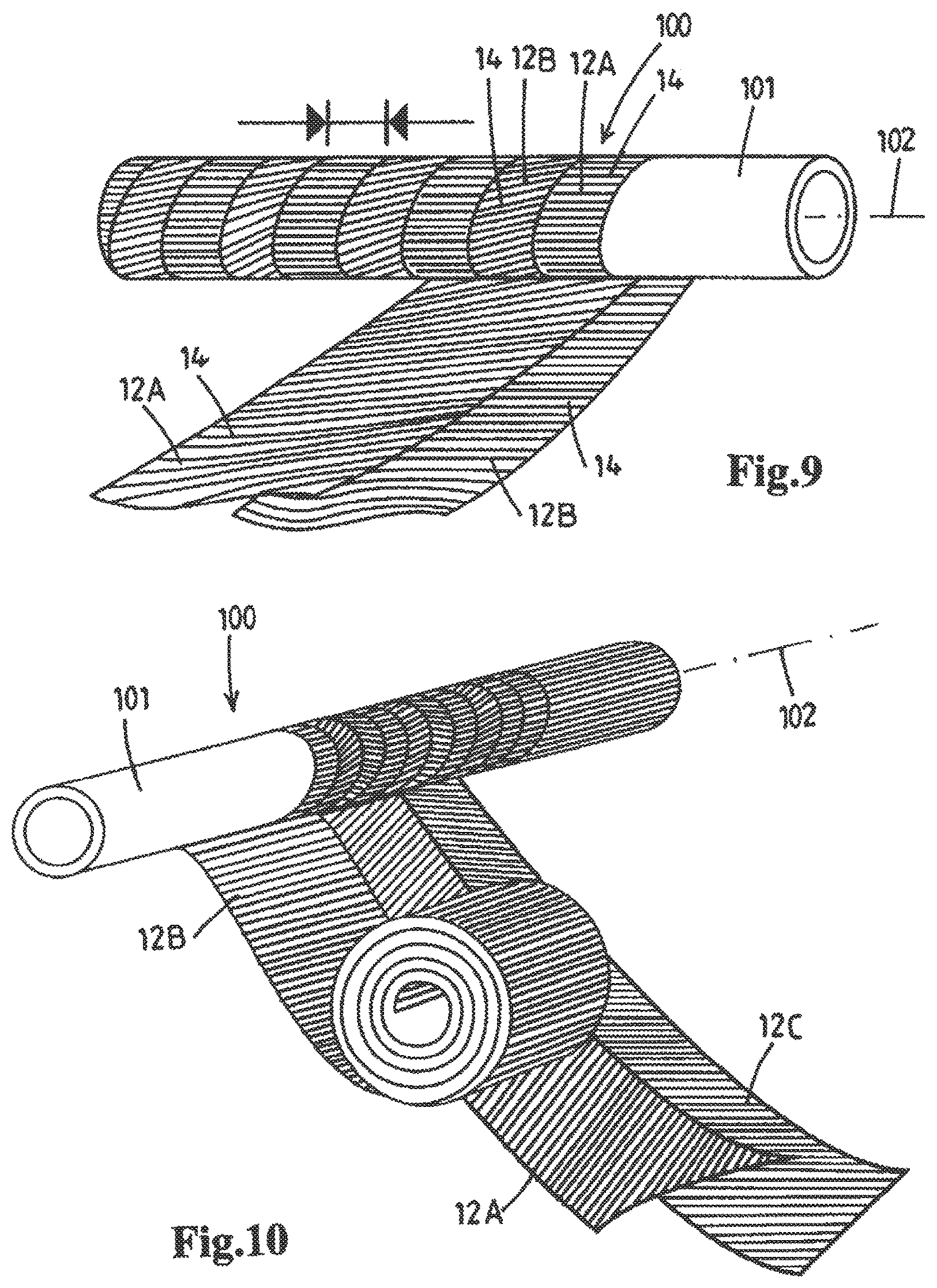 Patent US12129583 Figure 16 – Method and device for producing a ribbon and a thread of bamboo fiber