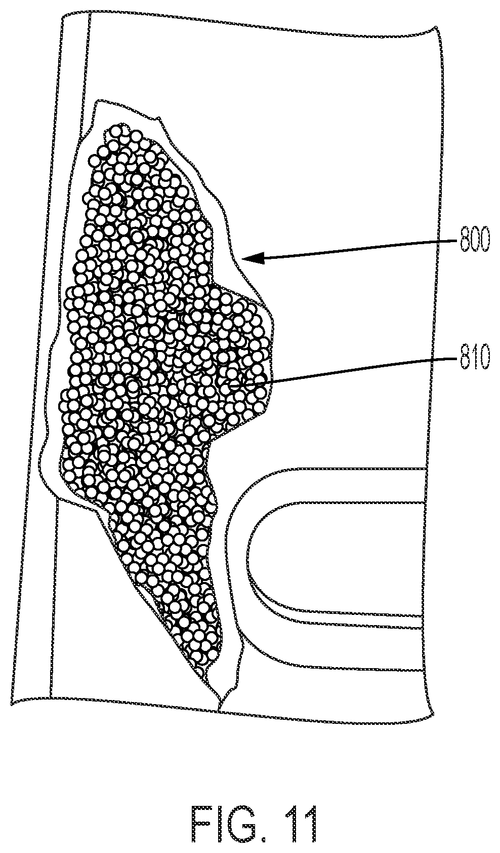 Patent US12129605 Figure 11 – Apparatus and method for repairing mats