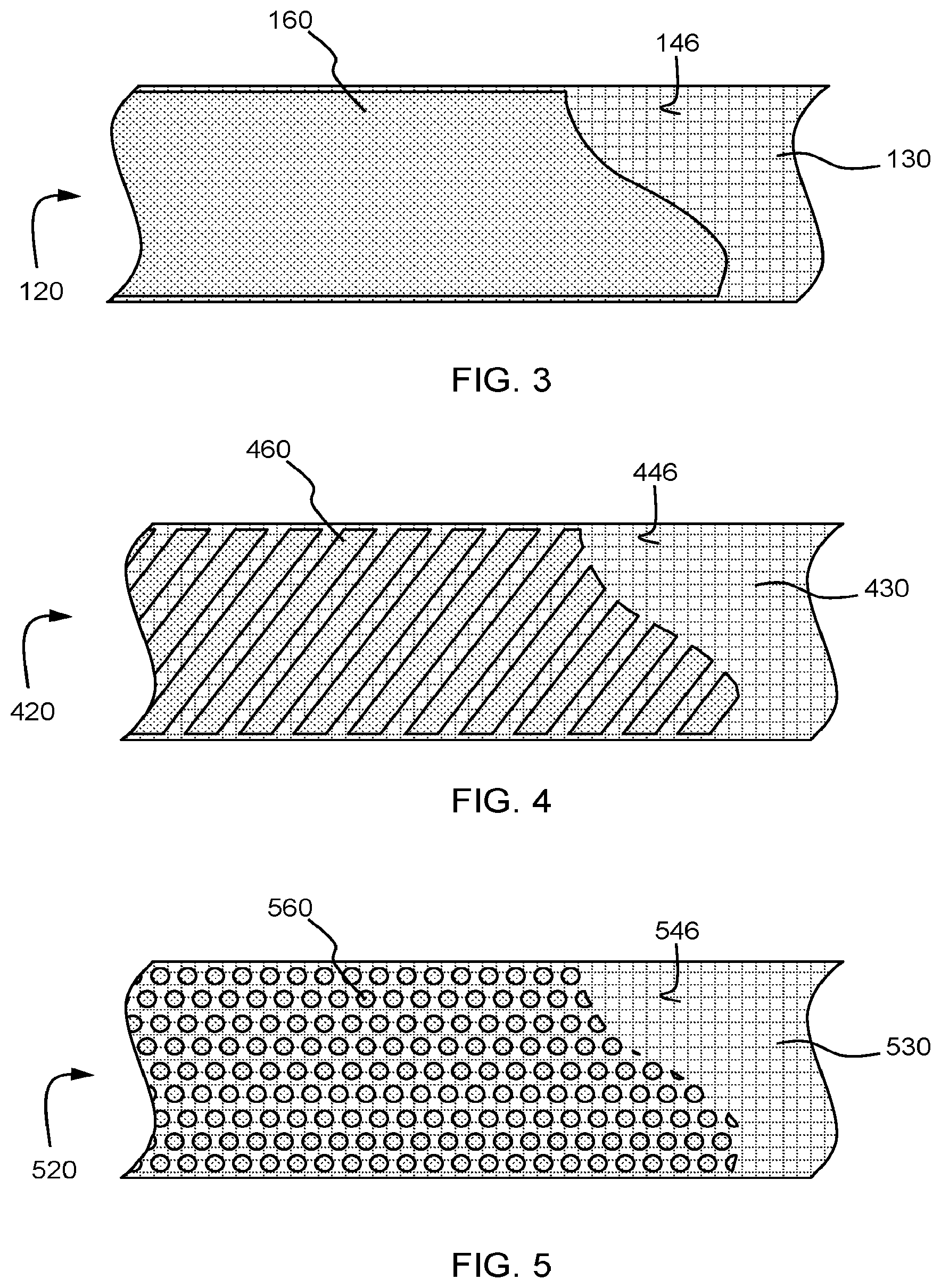 Patent US12129655 Figure 2 – Joint support including adhesive layer, system including joint support, and method of use