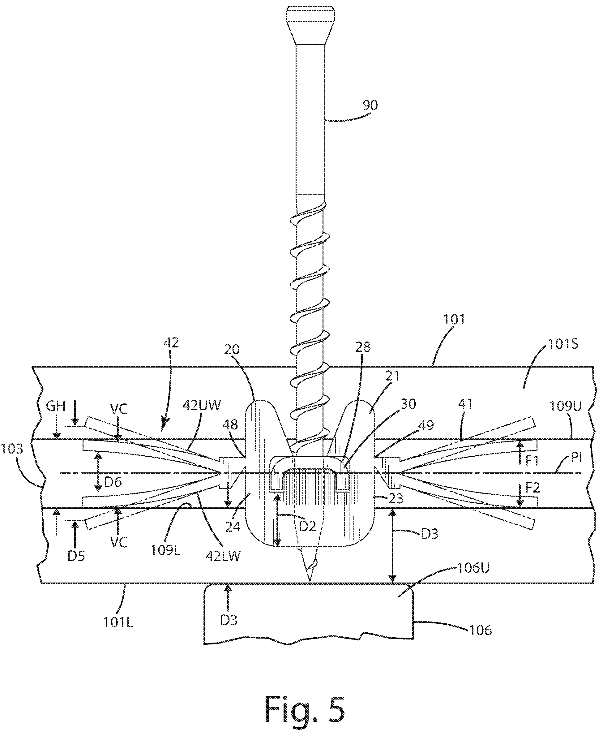 Patent US12129663 Figure 5 – Hidden fastener unit and related method of use
