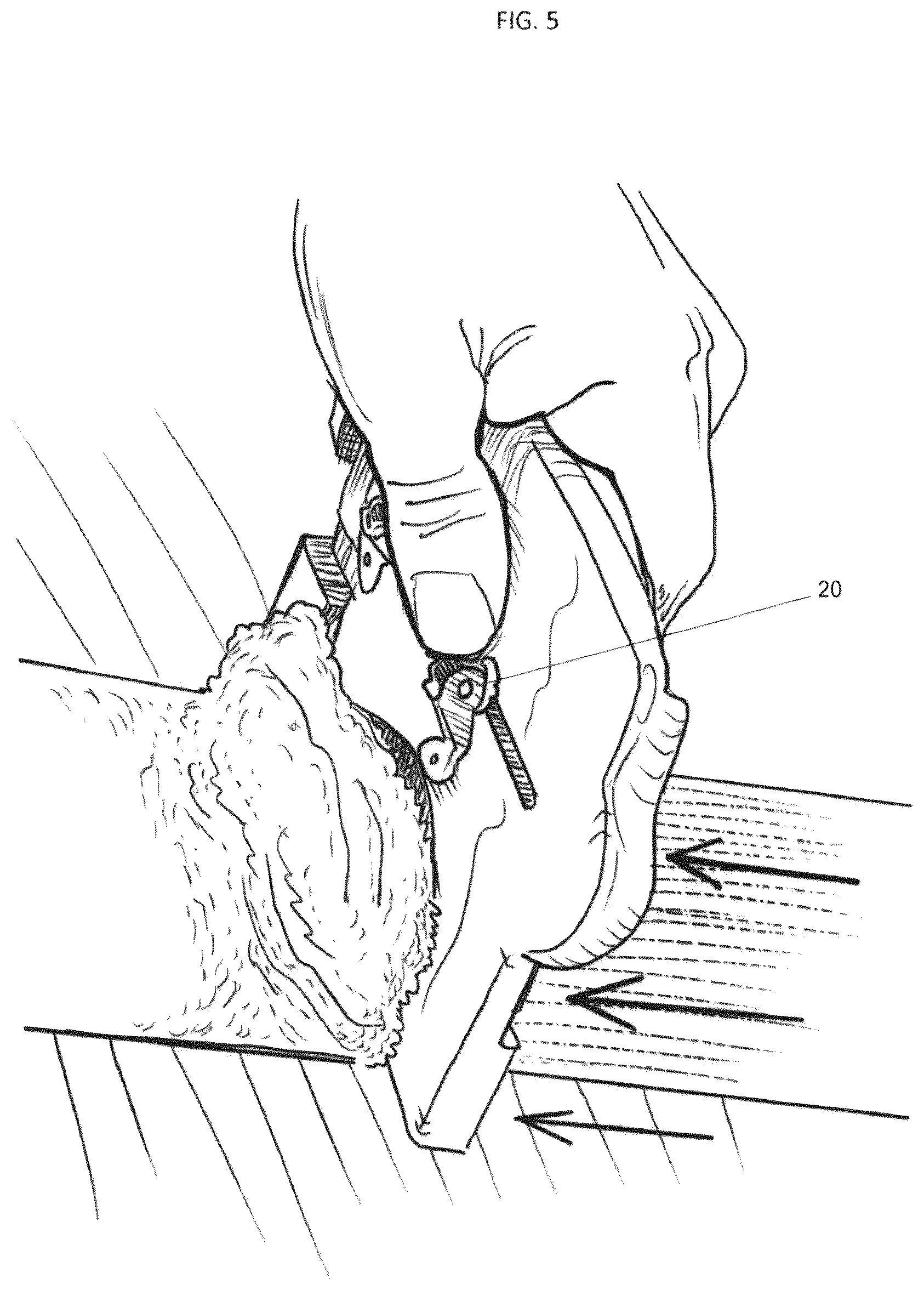 Patent US12129669 Figure 4 – Application device for the placement of spreadable substrates