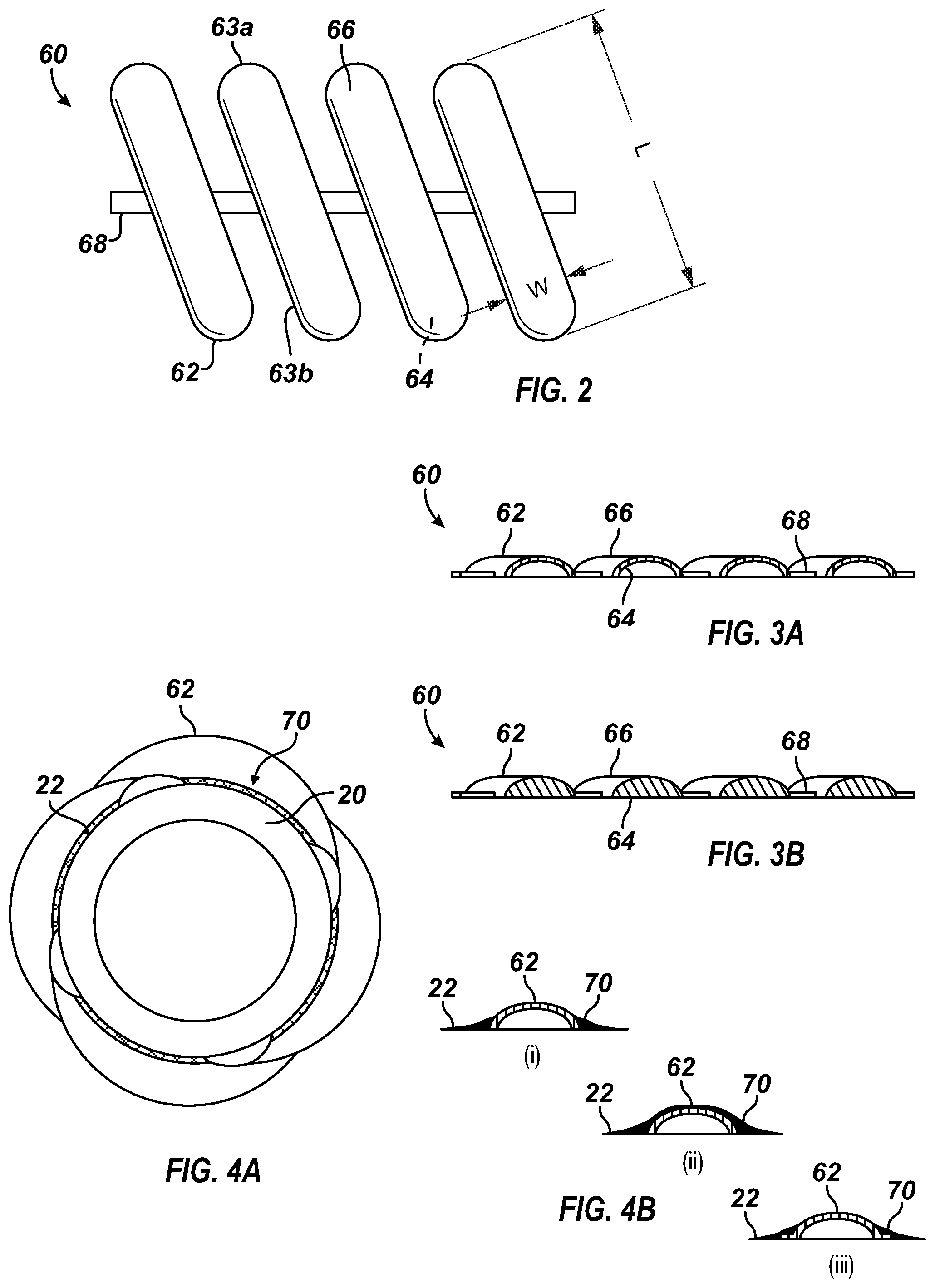 Patent US12129718 Figure 2 – Apparatus and method to form centralizer blades on wellbore tubular
