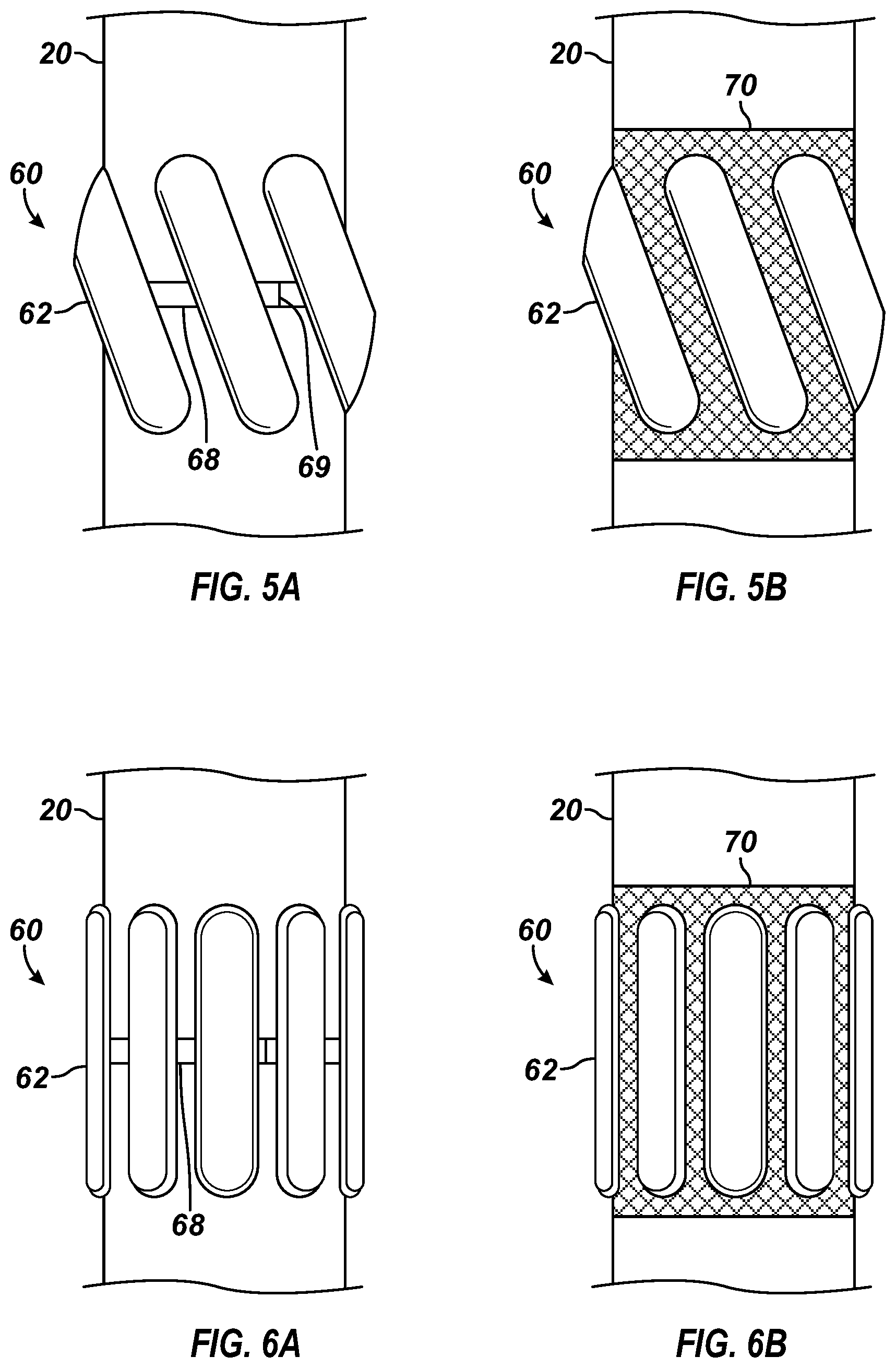 Patent US12129718 Figure 3 – Apparatus and method to form centralizer blades on wellbore tubular