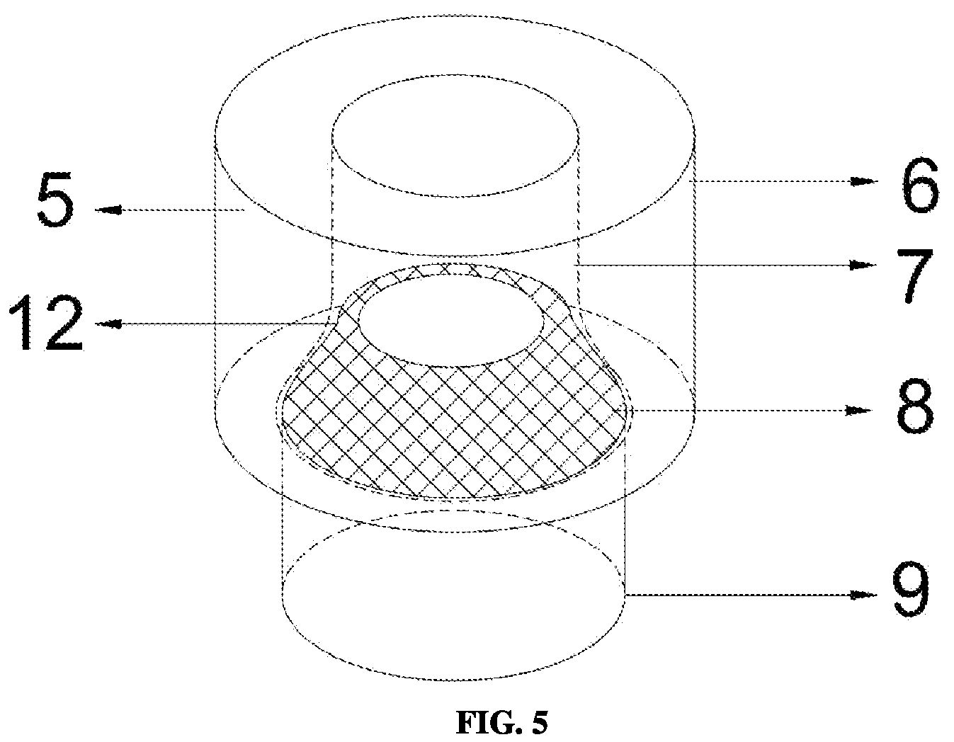 Patent US12129760 Figure 4 – Multi-stage pressure yielding and anti-impact device for anchoring support