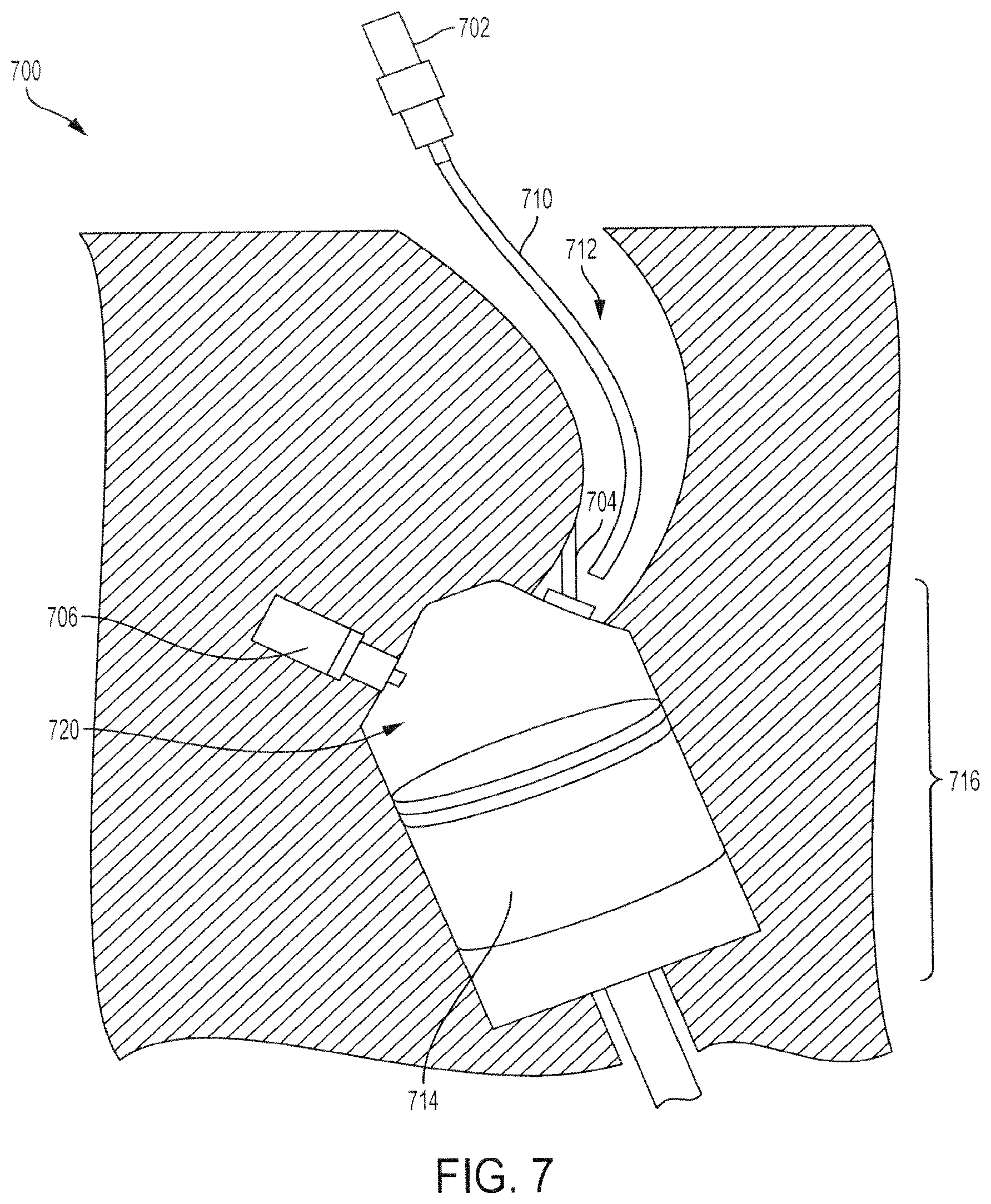 Patent US12129786 Figure 7 – Explosion safe electrolysis unit