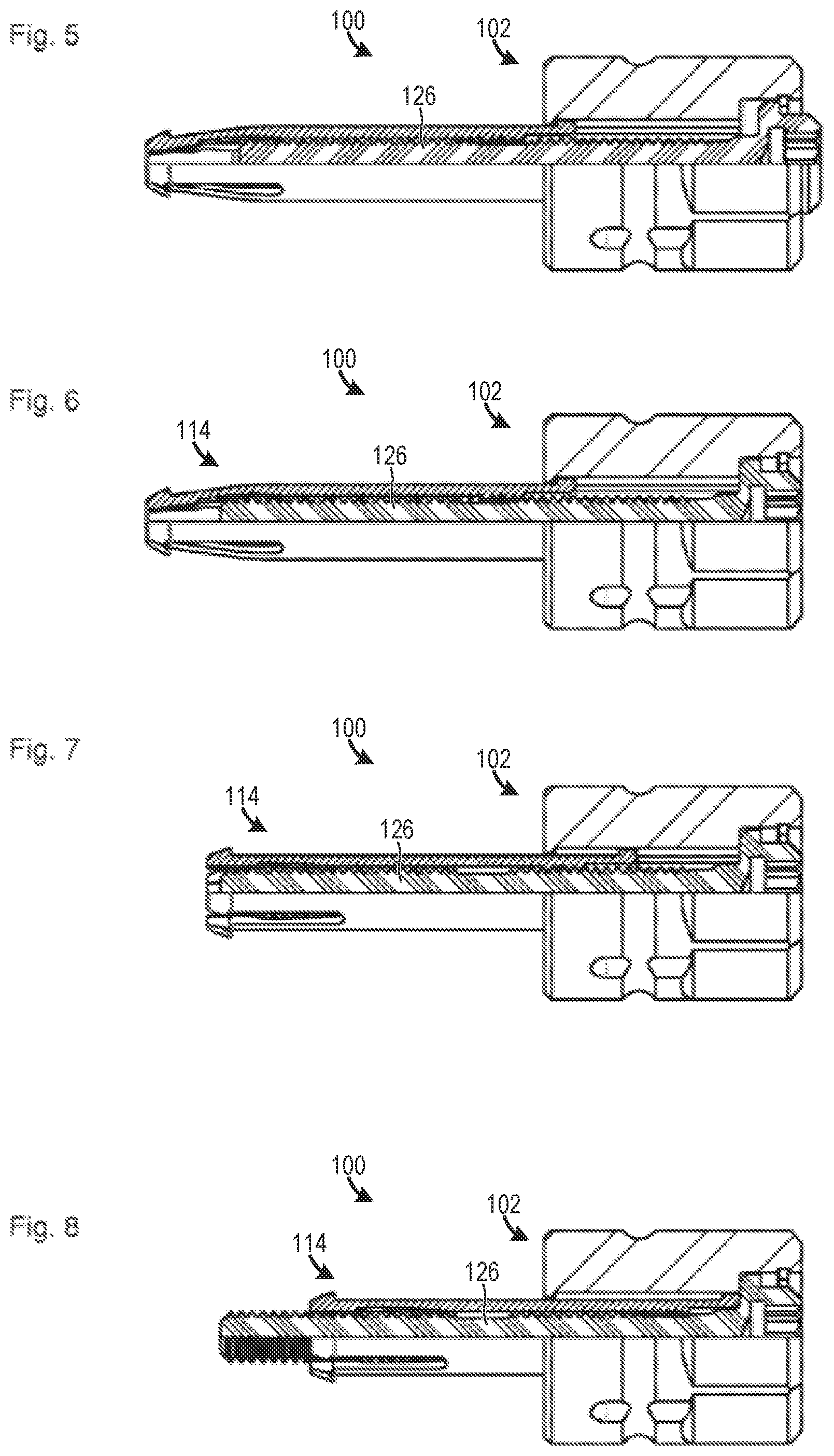 Patent US12129882 Figure 2 – One piece screws for, and methods for making and using, blind side fasteners and systems with free spin feature
