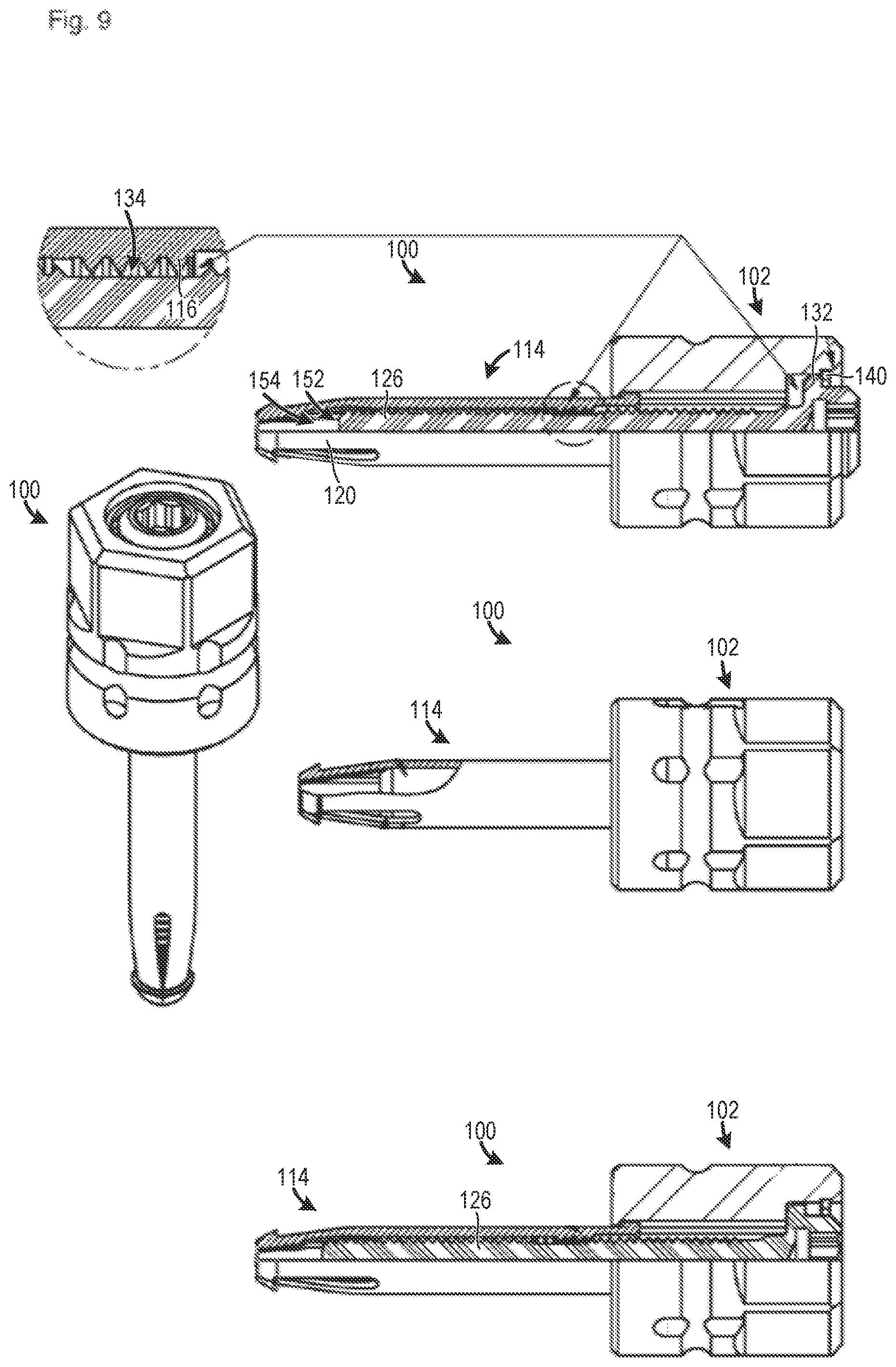 Patent US12129882 Figure 3 – One piece screws for, and methods for making and using, blind side fasteners and systems with free spin feature