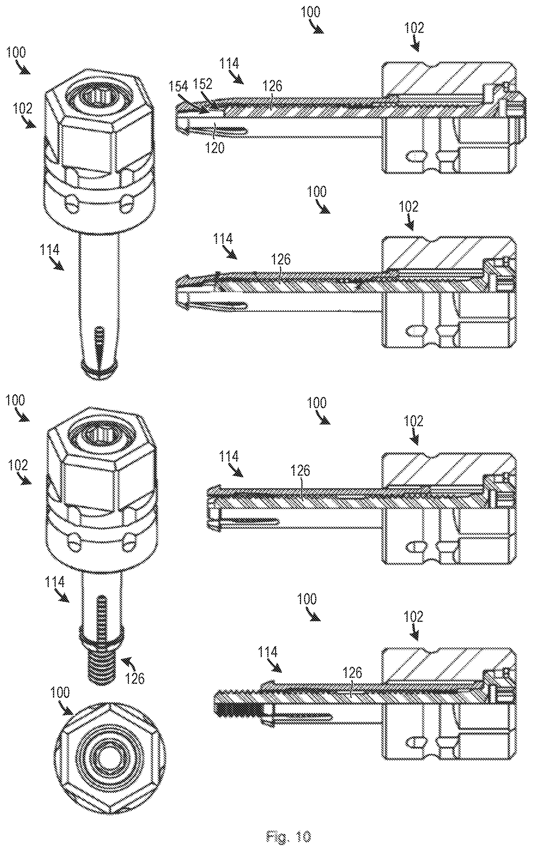 Patent US12129882 Figure 4 – One piece screws for, and methods for making and using, blind side fasteners and systems with free spin feature