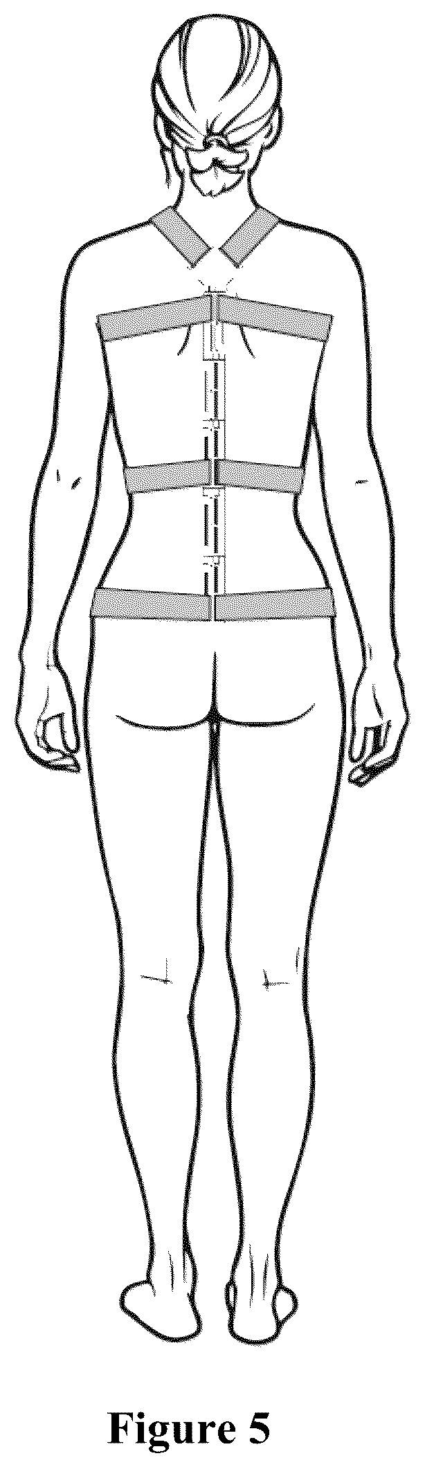 Patent US12129886 Figure 5 – Orthopedic hinge assembly