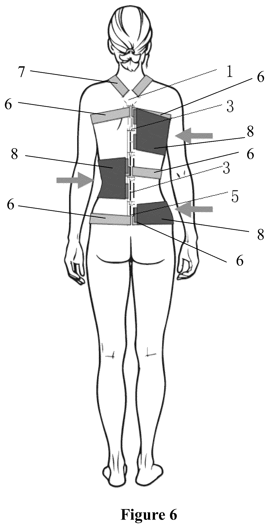 Patent US12129886 Figure 6 – Orthopedic hinge assembly