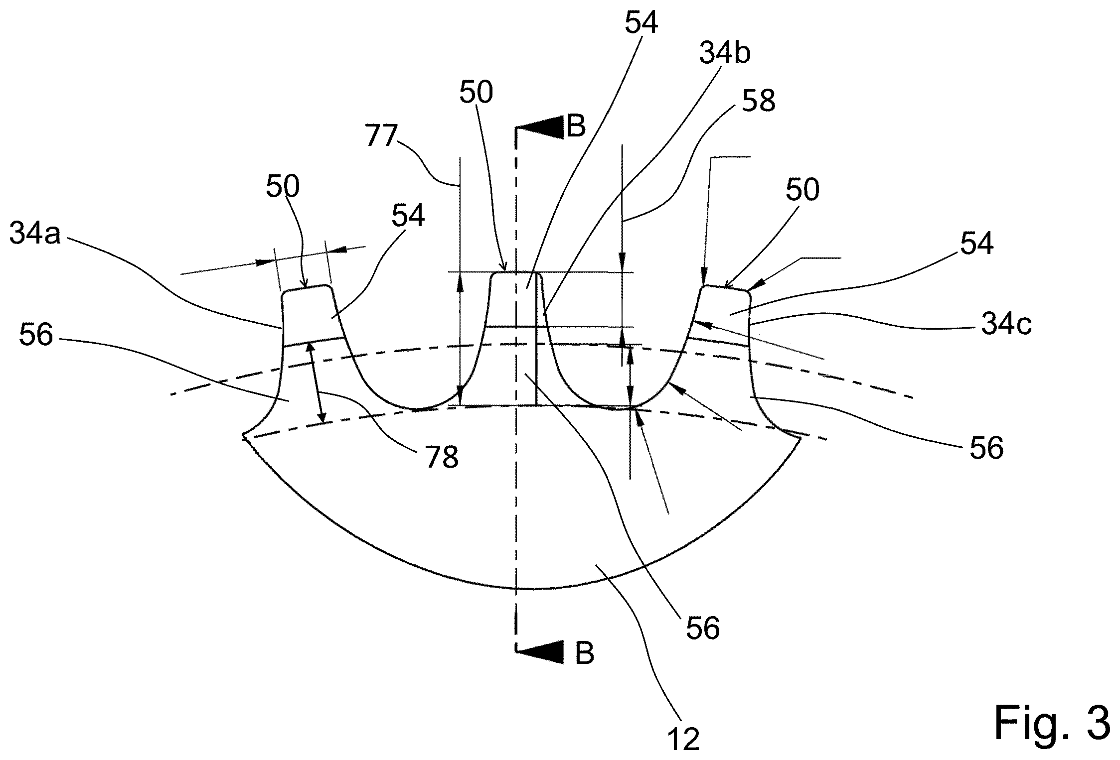 Patent US12129910 Figure 3 – Drive chain and method for manufacturing a drive-chain