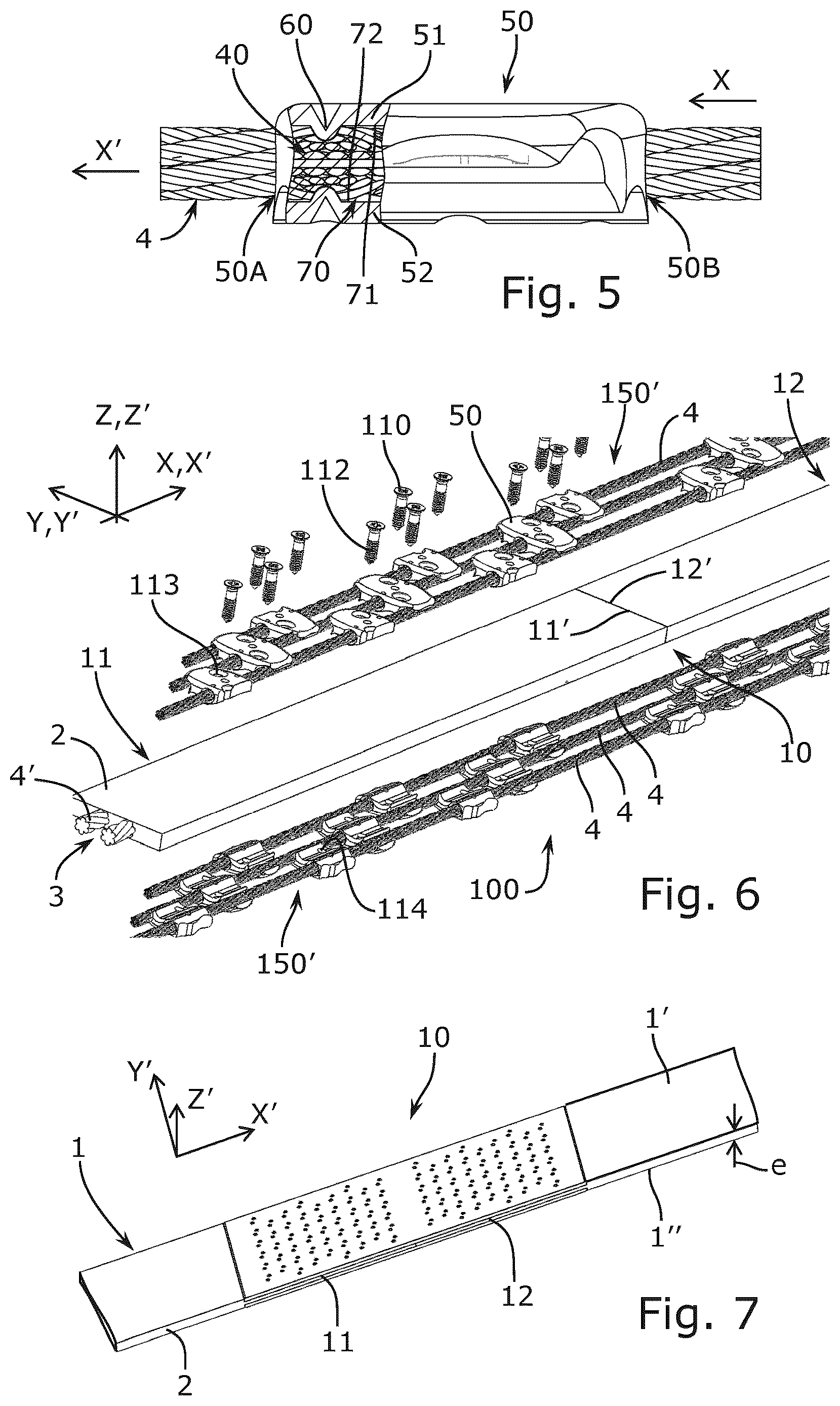 Patent US12129912 Figure 3 – Cable conveyor belt joining device provided with cable locking elements
