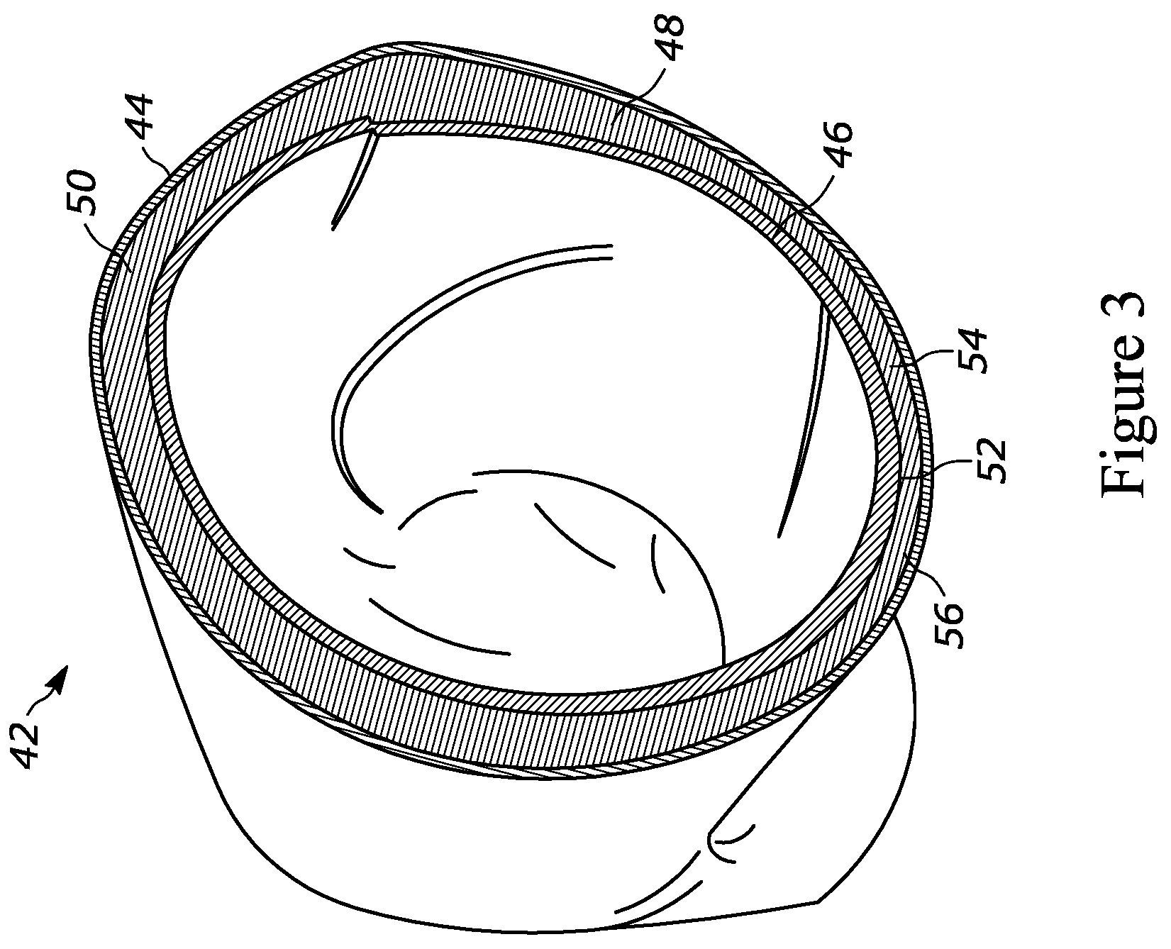 Patent US12129937 Figure 3 – Alternative subprocess for taping wrapped silicon hoses and hose manufactured thereby
