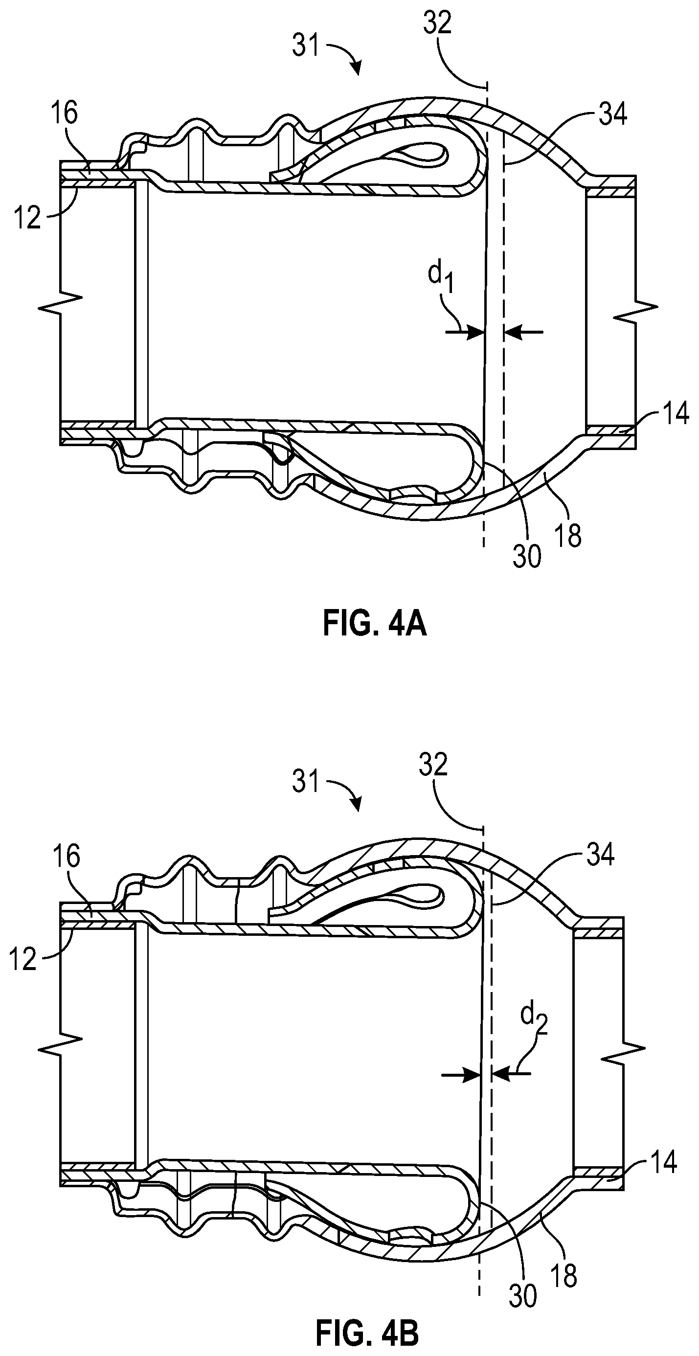 Patent US12129945 Figure 3 – Tube assembly