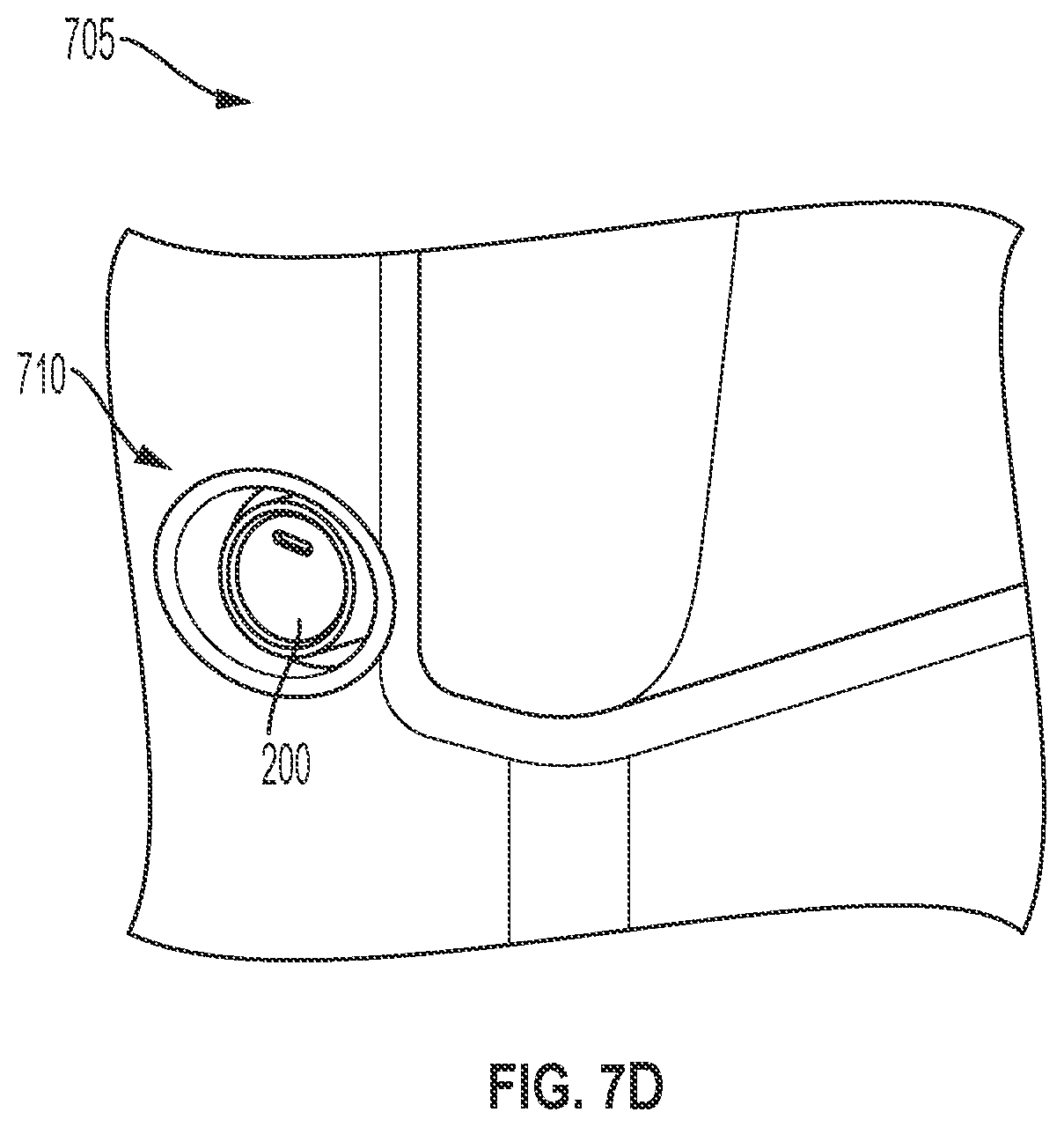 Patent US12129975 Figure 10 – Apparatus with accelerometer