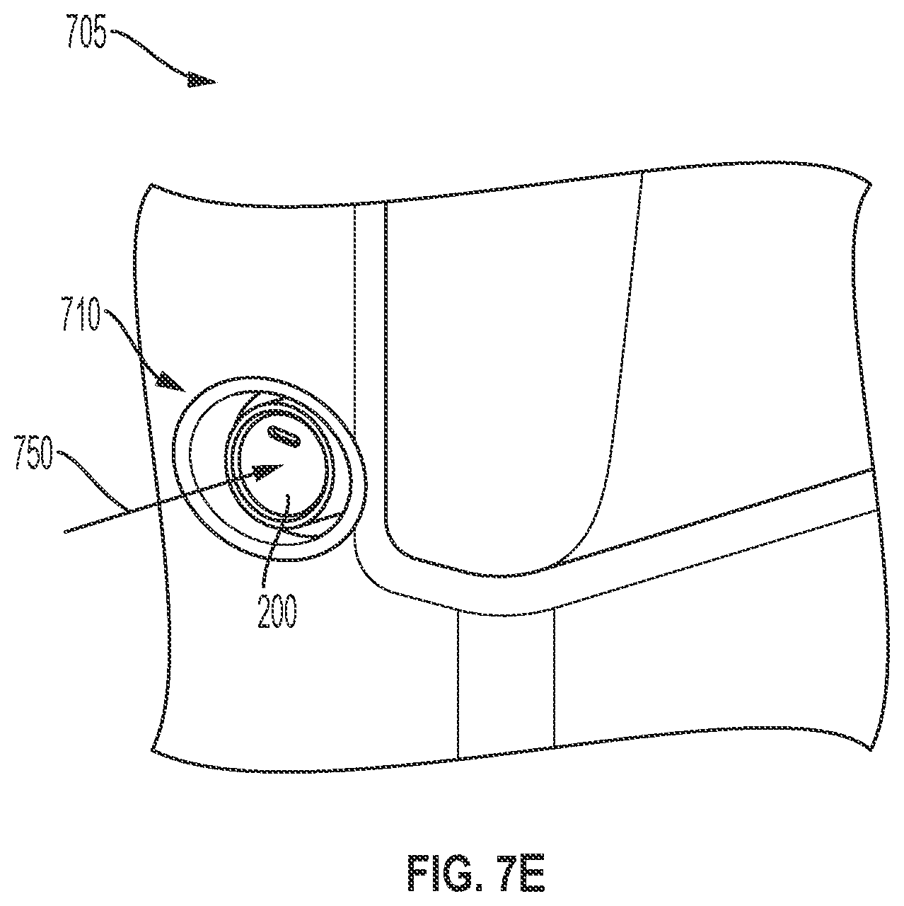 Patent US12129975 Figure 11 – Apparatus with accelerometer