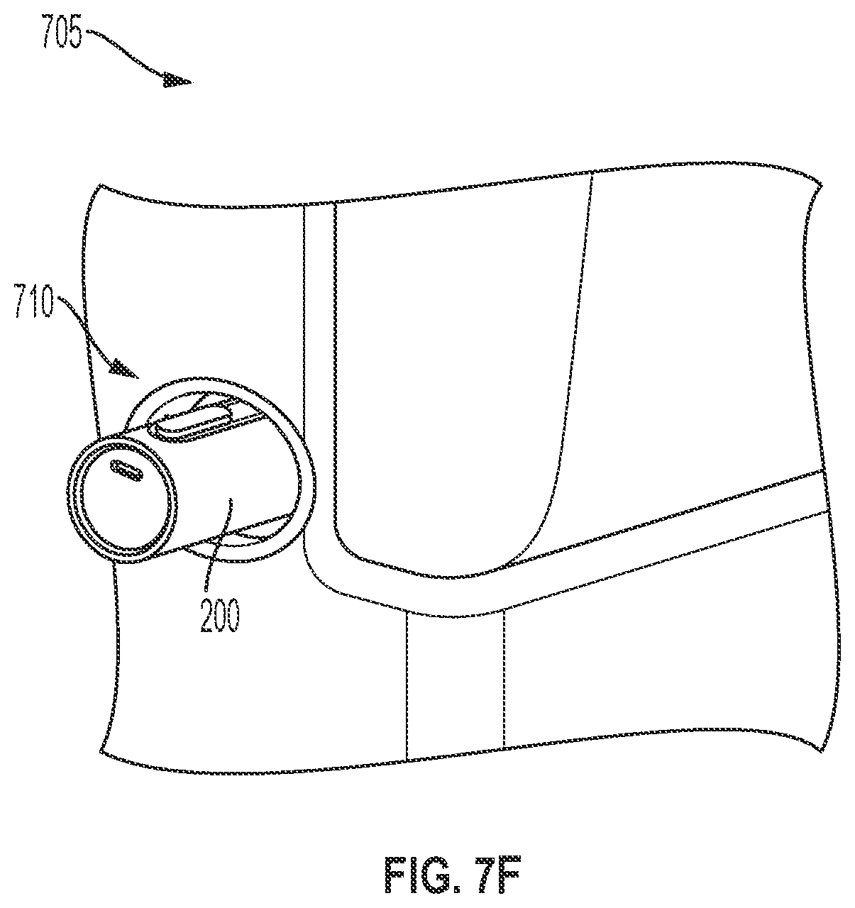 Patent US12129975 Figure 12 – Apparatus with accelerometer