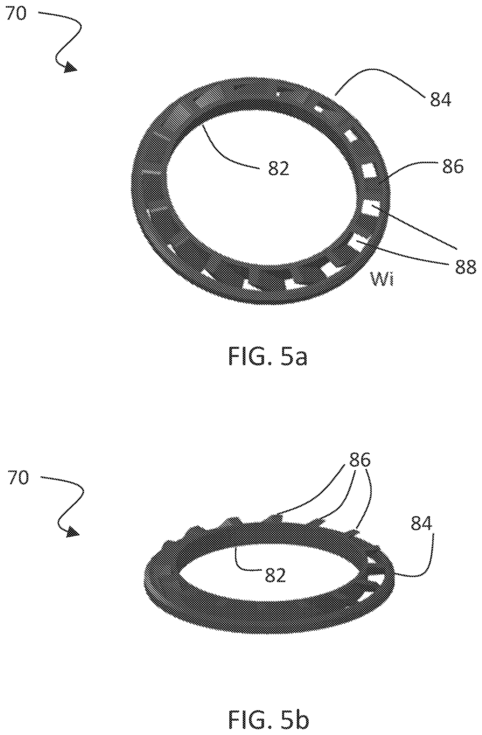 Patent US12134054 Figure 5 – Filter system and replaceable filter cartridge