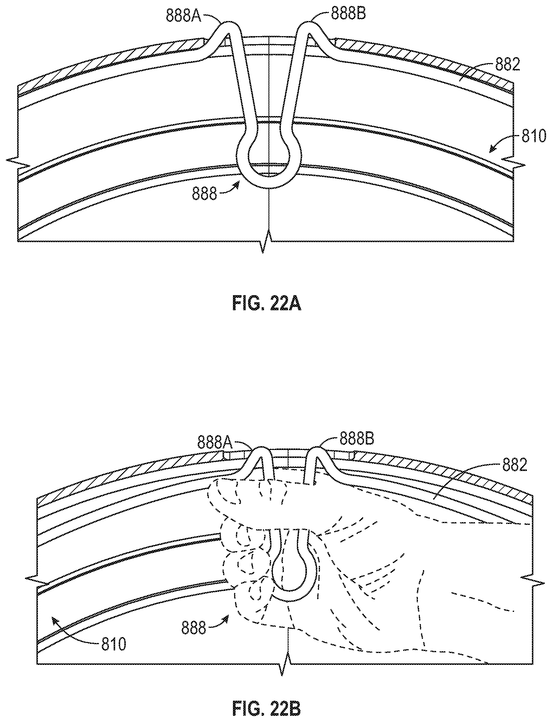 Patent US12134284 Figure 17 – Aerodynamic cover for a vehicle wheel, attachment system for the aerodynamic cover to the vehicle wheel, and vehicle wheel having such an aerodynamic cover and attachment system