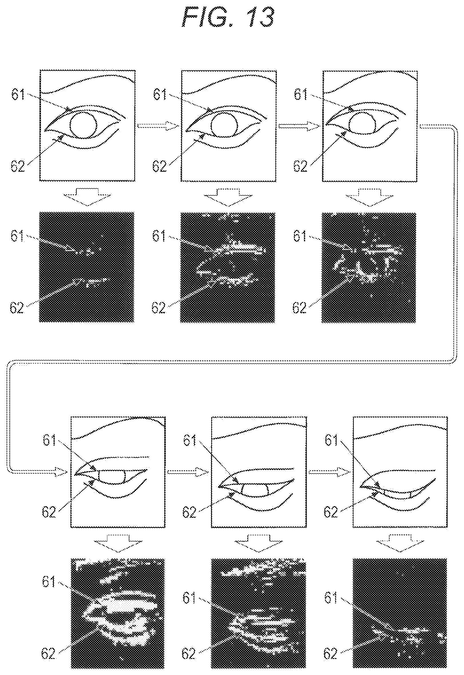 Patent US12134316 Figure 10 – State detection device, state detection system, and state detection method