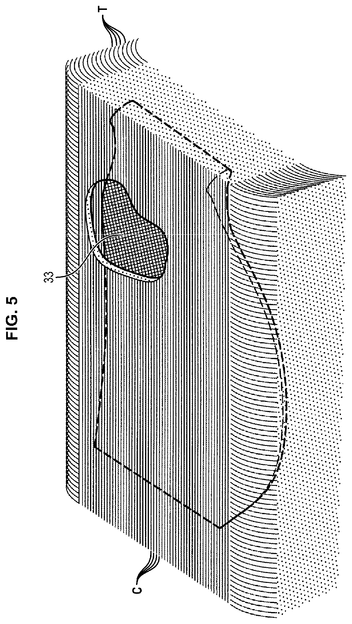 Patent US12134460 Figure 5 – Blade comprising a composite material structure and associated manufacturing method
