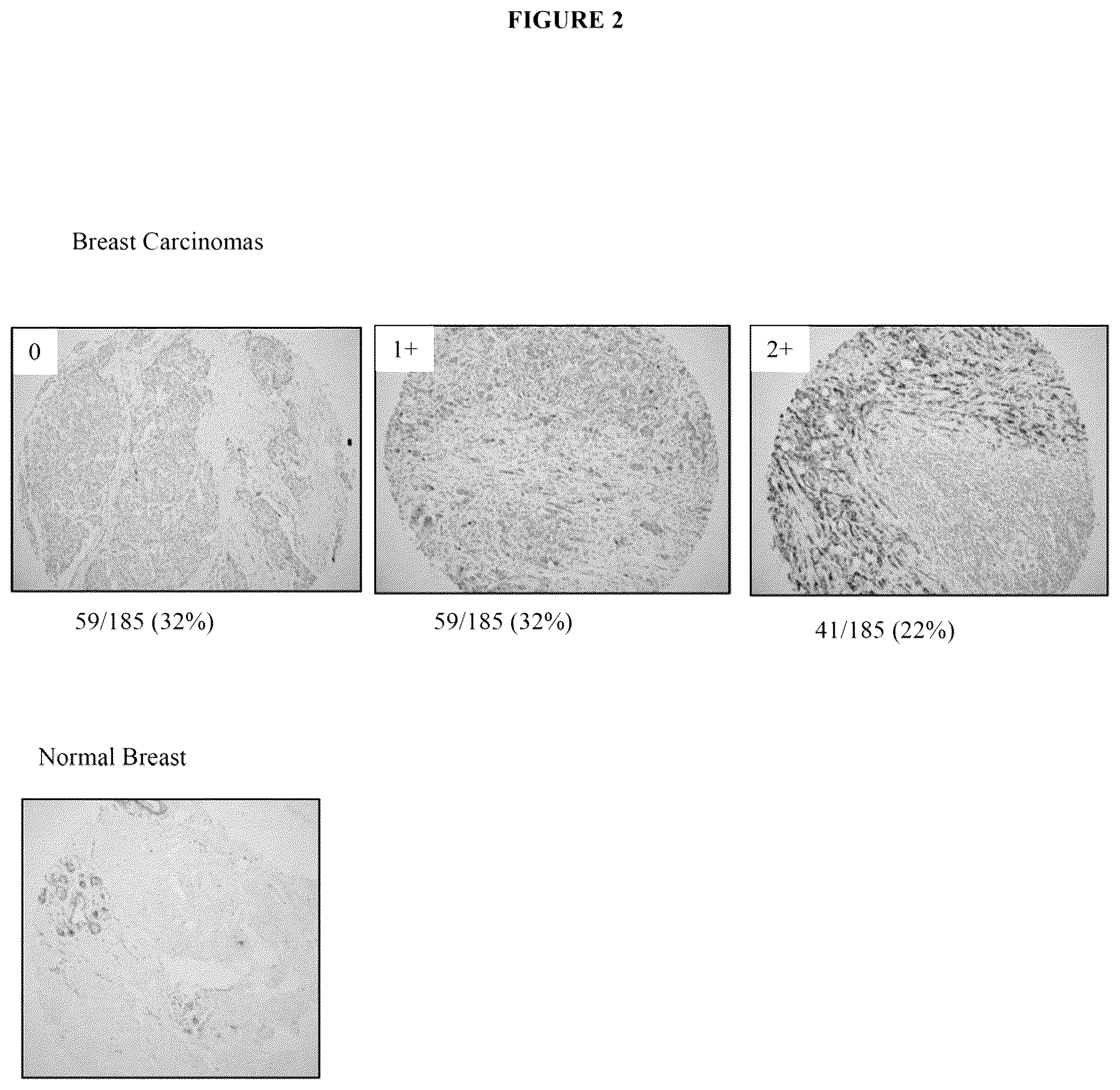 Patent US12134649 Figure 2 – Anti-B7-H4 antibodies and immunoconjugates