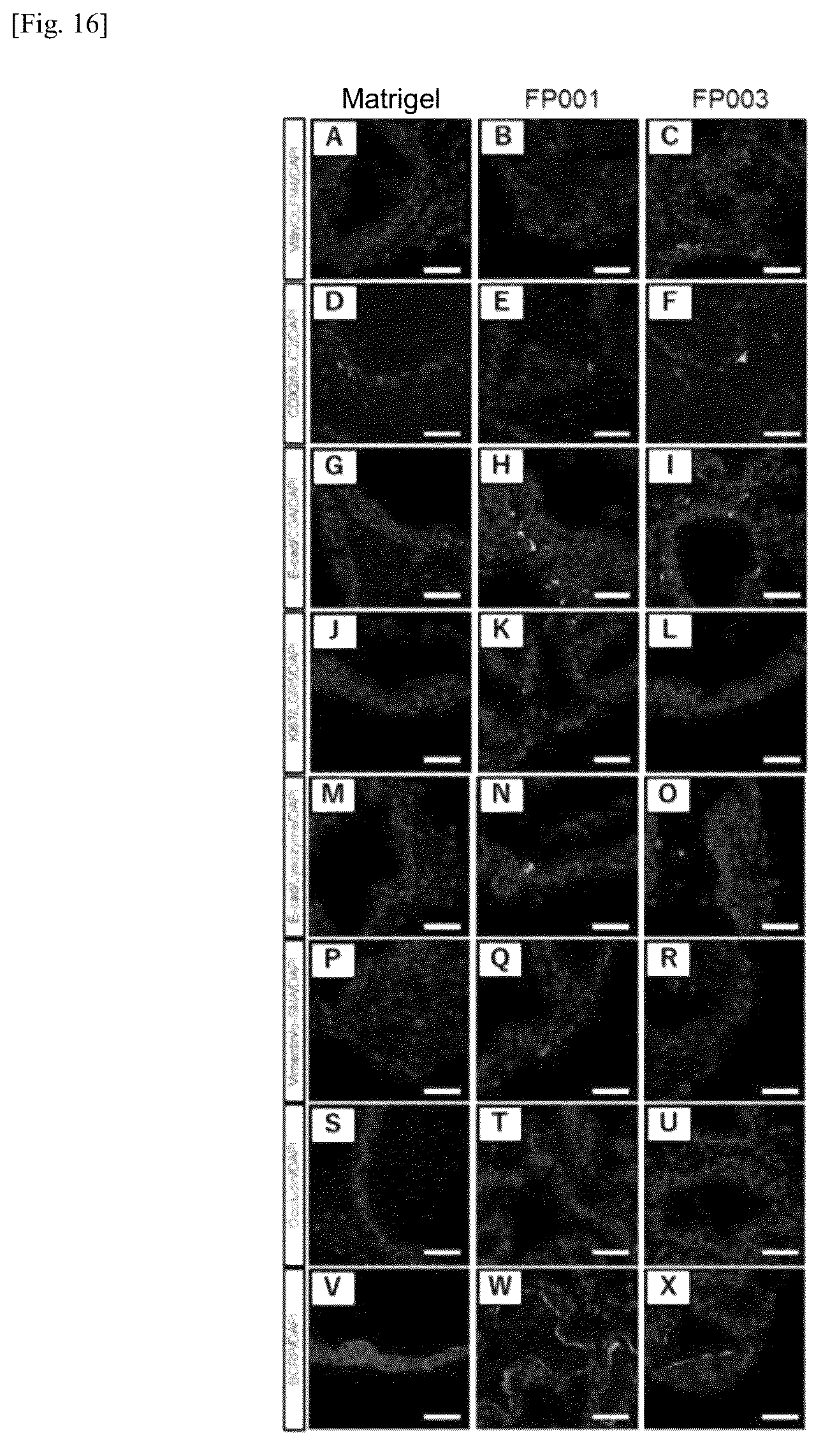 Patent US12134784 Figure 20 – Method for preparing intestinal tract cell layer derived from pluripotent stem cell