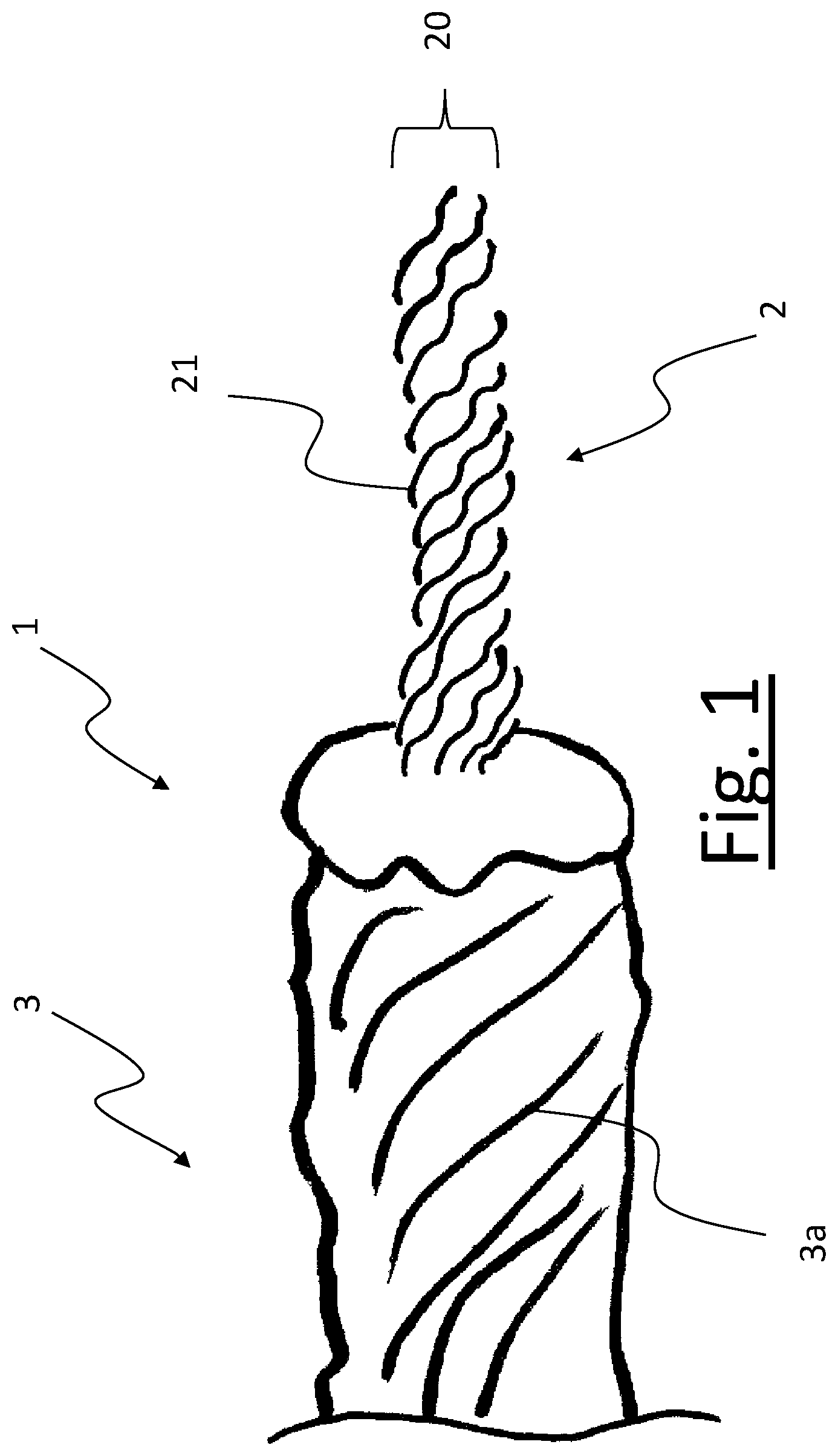 Patent US12134840 Figure 1 – Yarn comprising a core and a sheath