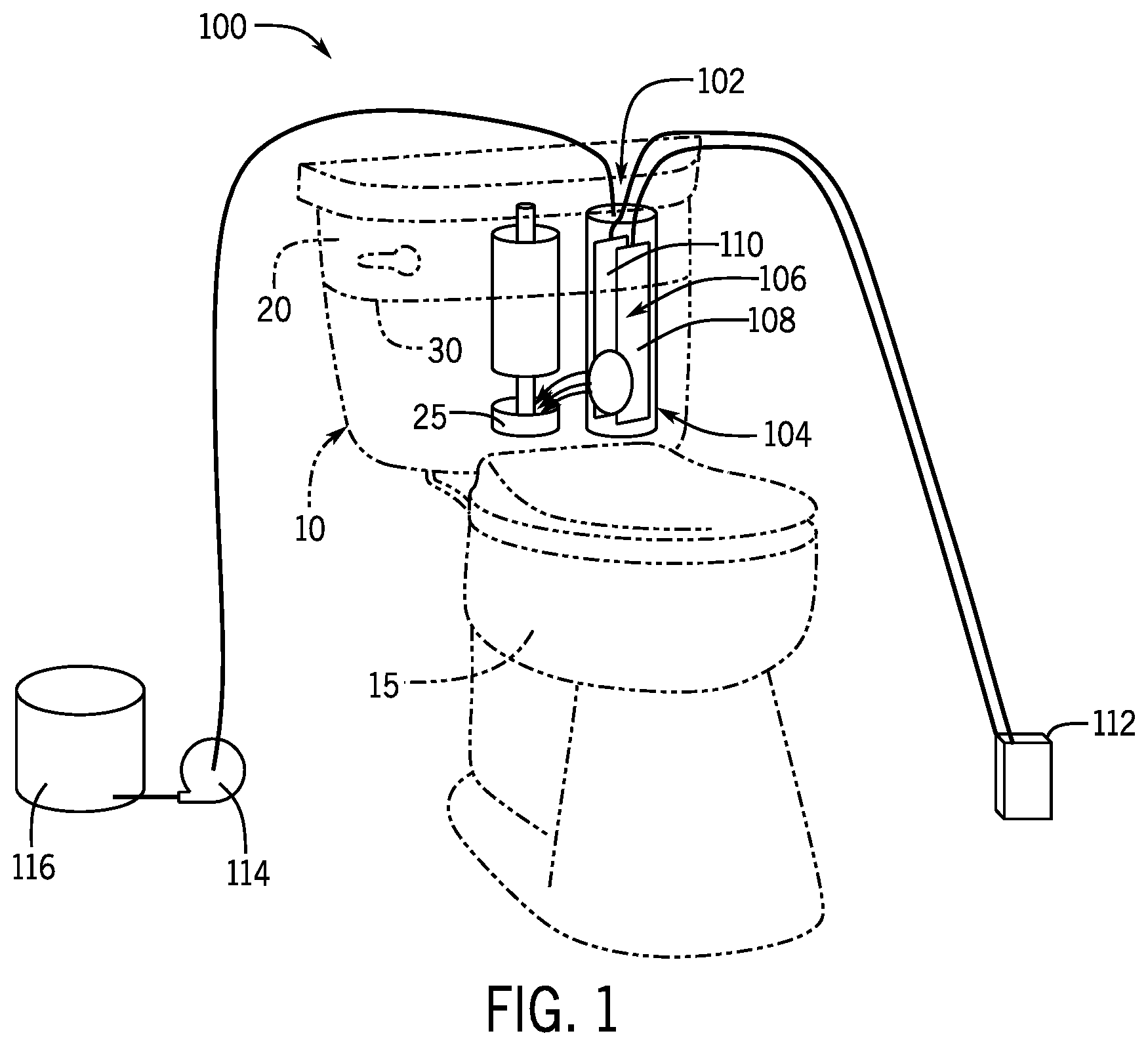 Patent US12134885 Figure 1 – Plumbing fixture with electro-chlorinating device