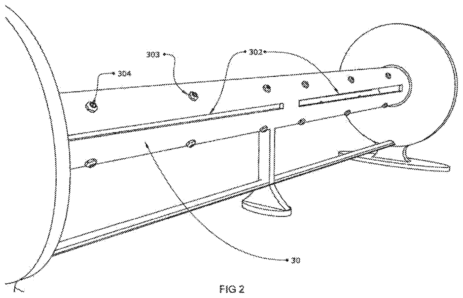 Patent US12137676 Figure 2 – Self-cleaning pre-filter for a water circulation pump