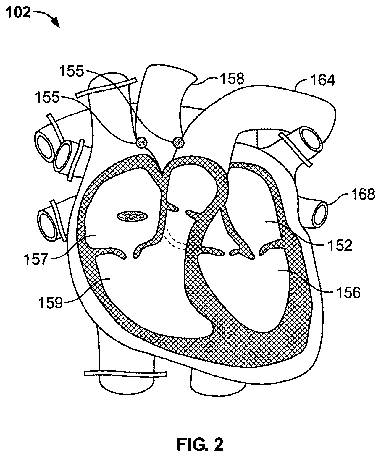 Patent US12137683 Figure 2 – Systems and methods for ex-vivo organ care