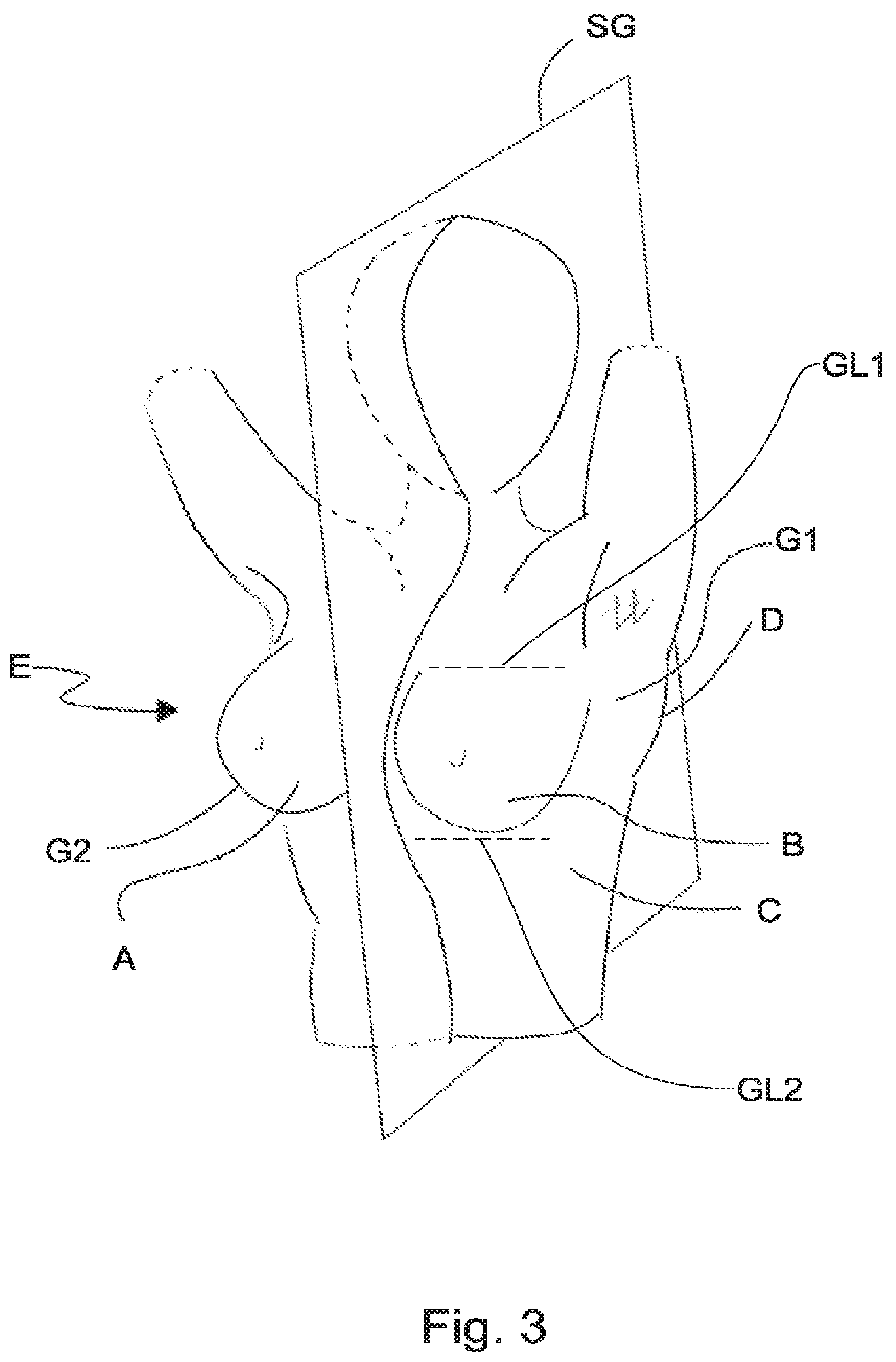 Patent US12137754 Figure 2 – Support for body portion