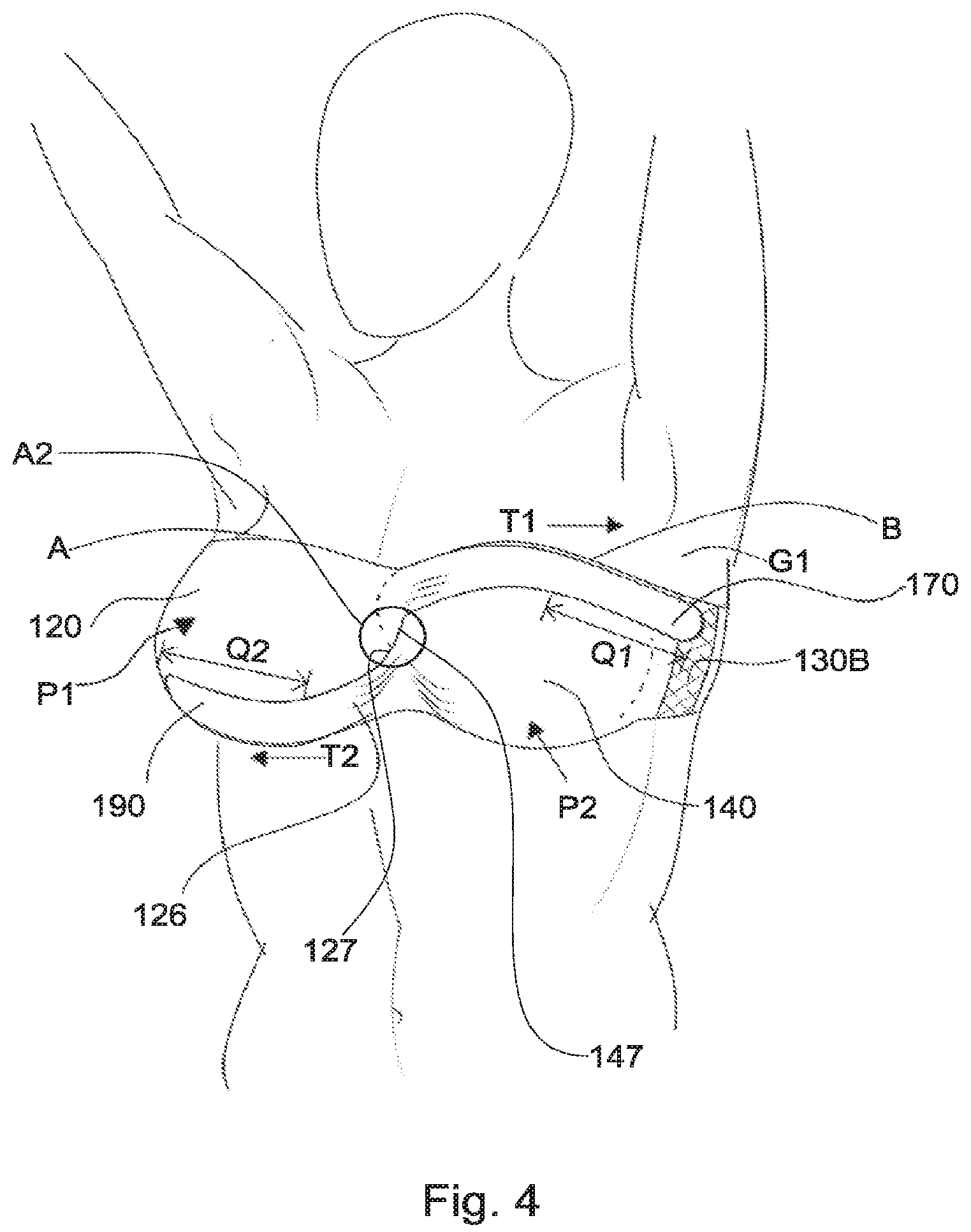 Patent US12137754 Figure 3 – Support for body portion