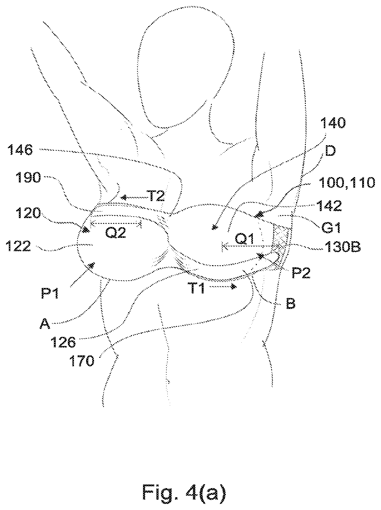 Patent US12137754 Figure 4 – Support for body portion