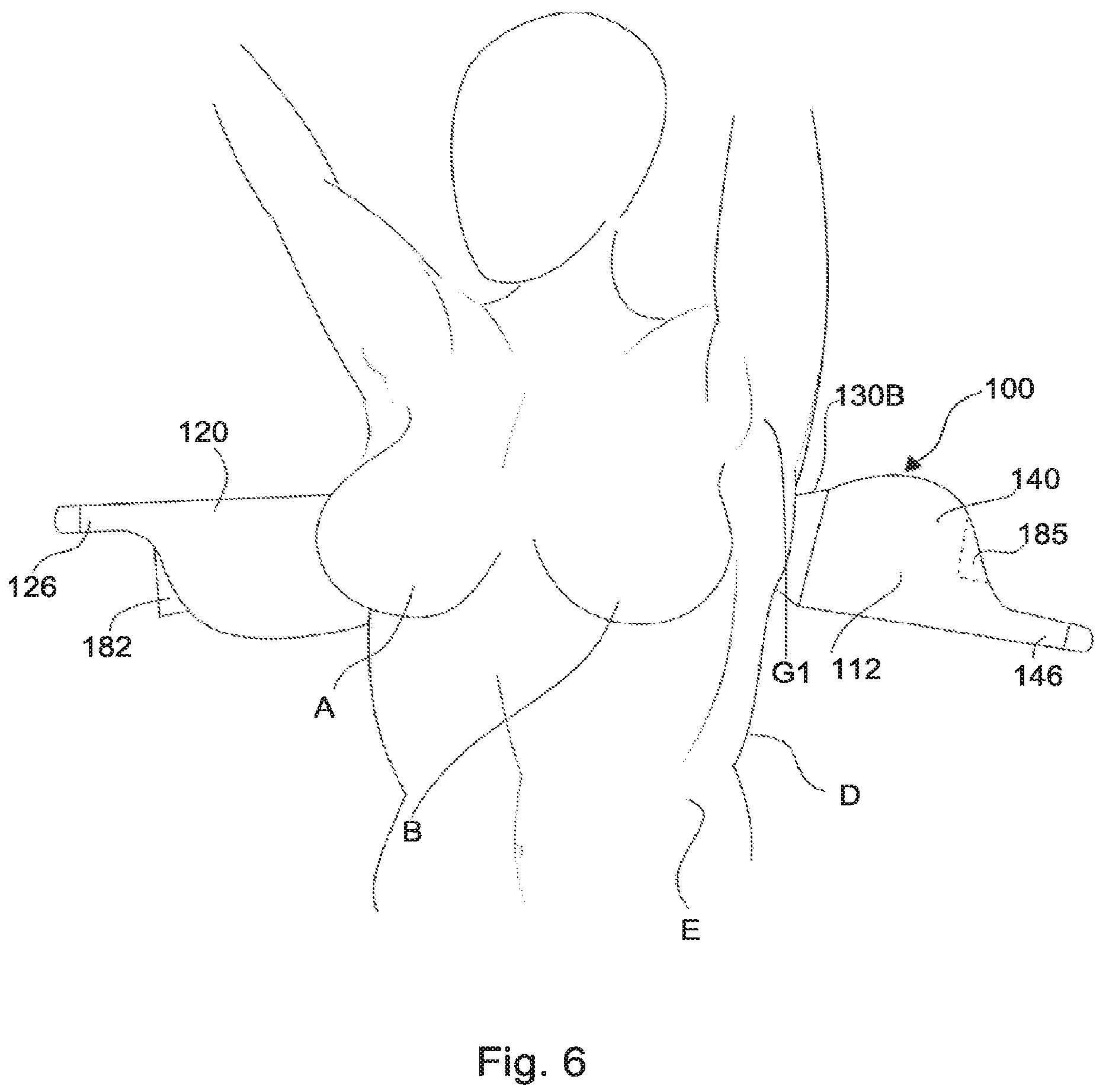 Patent US12137754 Figure 8 – Support for body portion