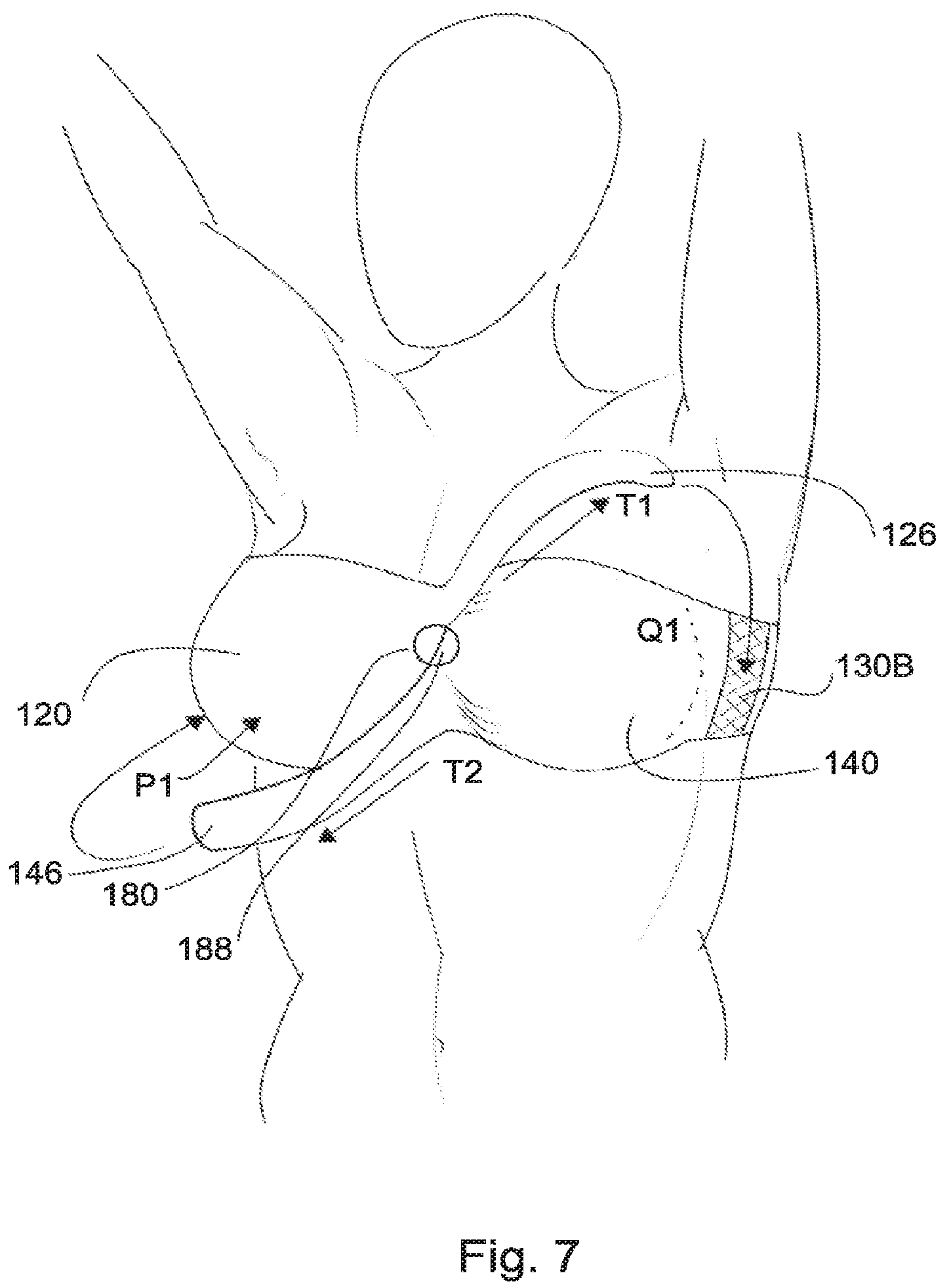 Patent US12137754 Figure 9 – Support for body portion