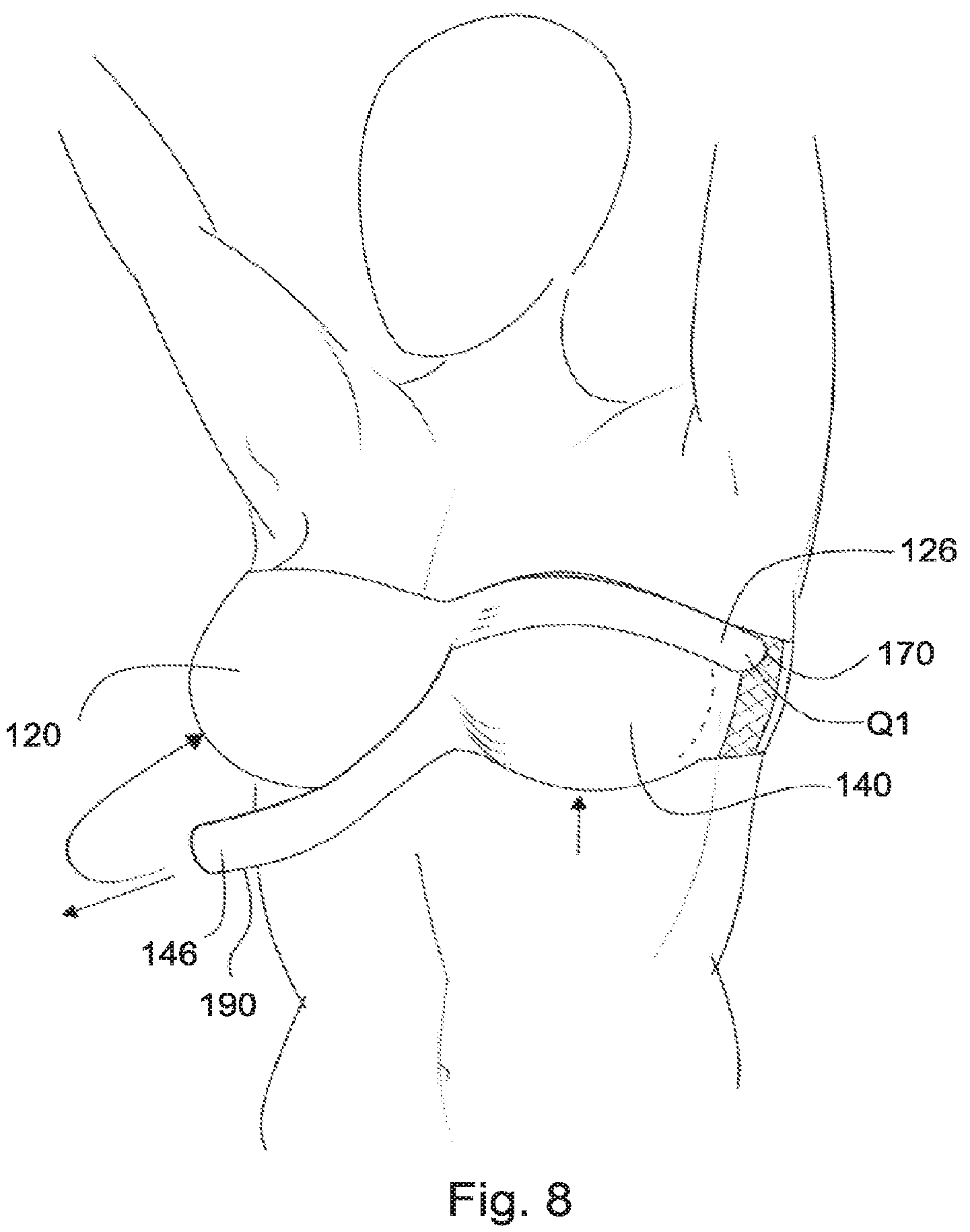 Patent US12137754 Figure 10 – Support for body portion