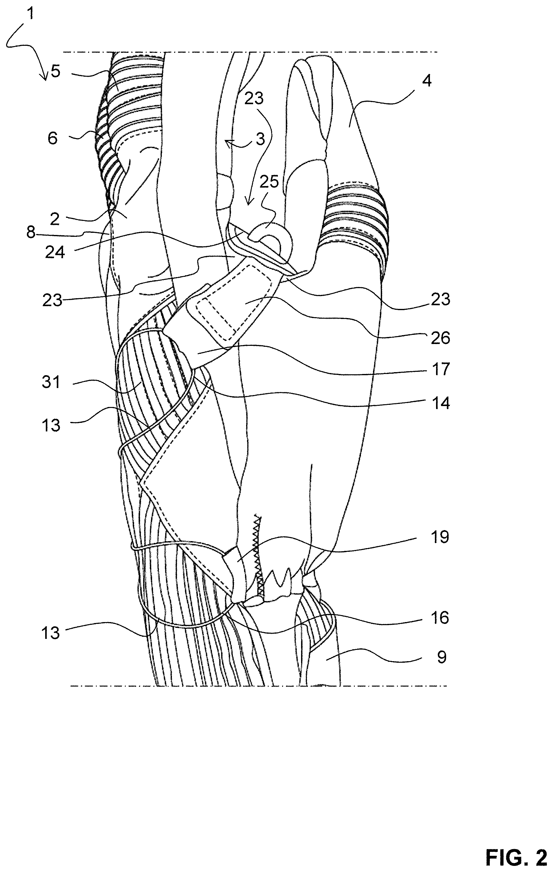 Patent US12137760 Figure 2 – Glove with lacing system