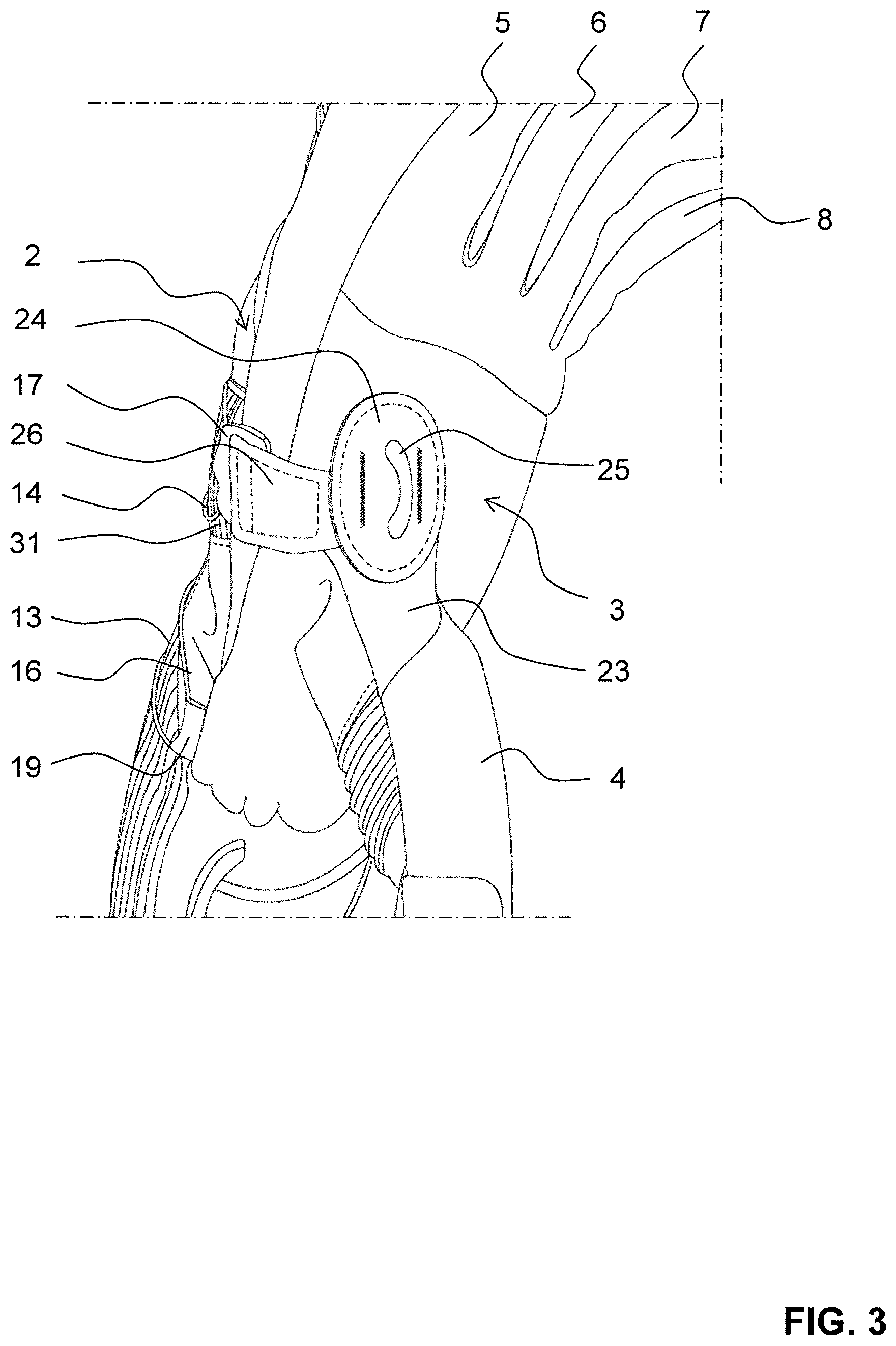 Patent US12137760 Figure 3 – Glove with lacing system