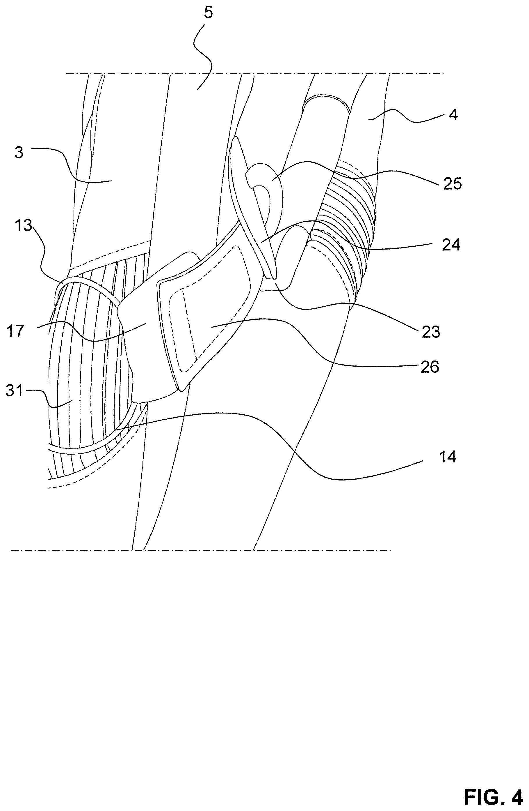 Patent US12137760 Figure 4 – Glove with lacing system