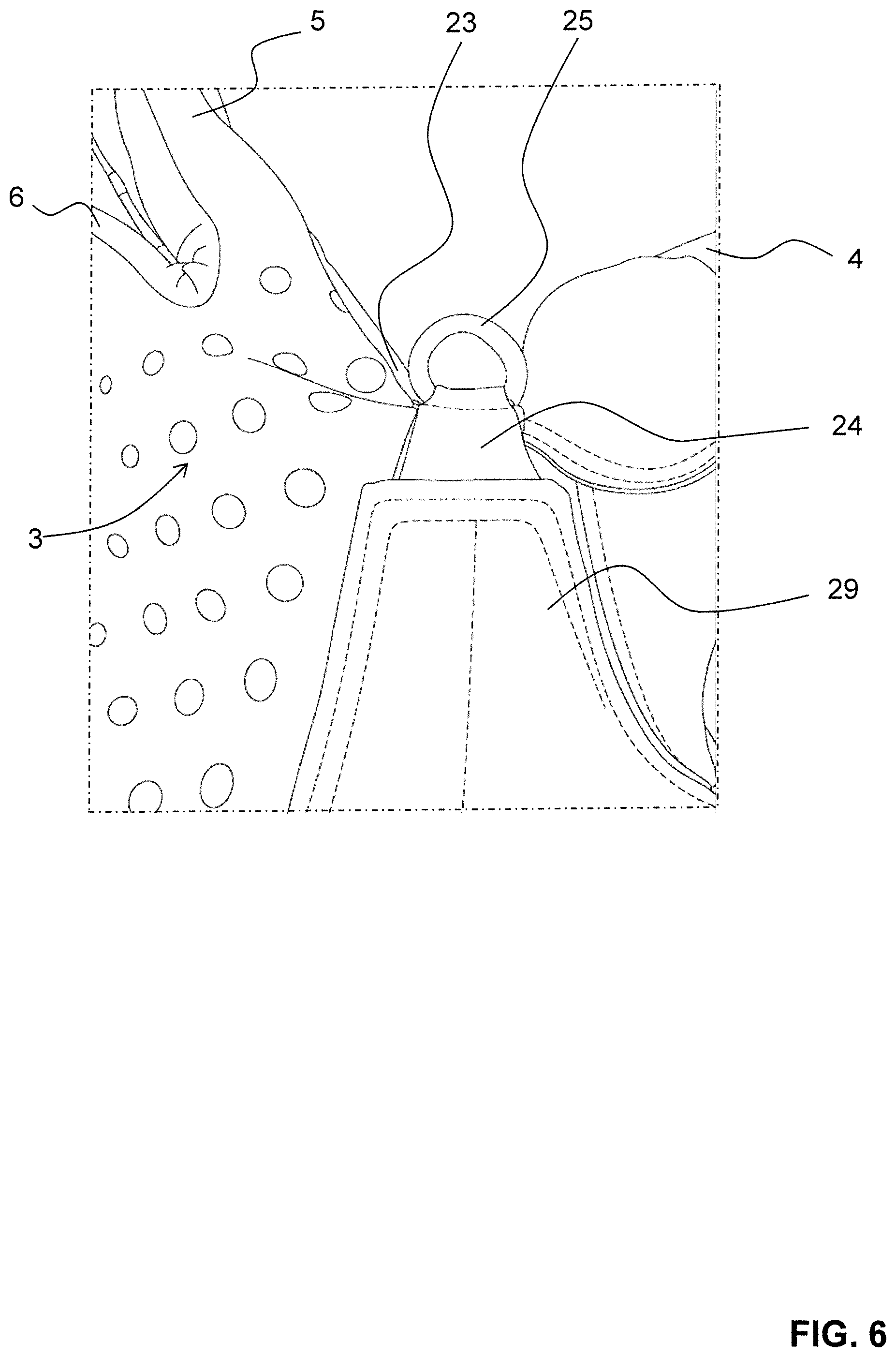 Patent US12137760 Figure 6 – Glove with lacing system