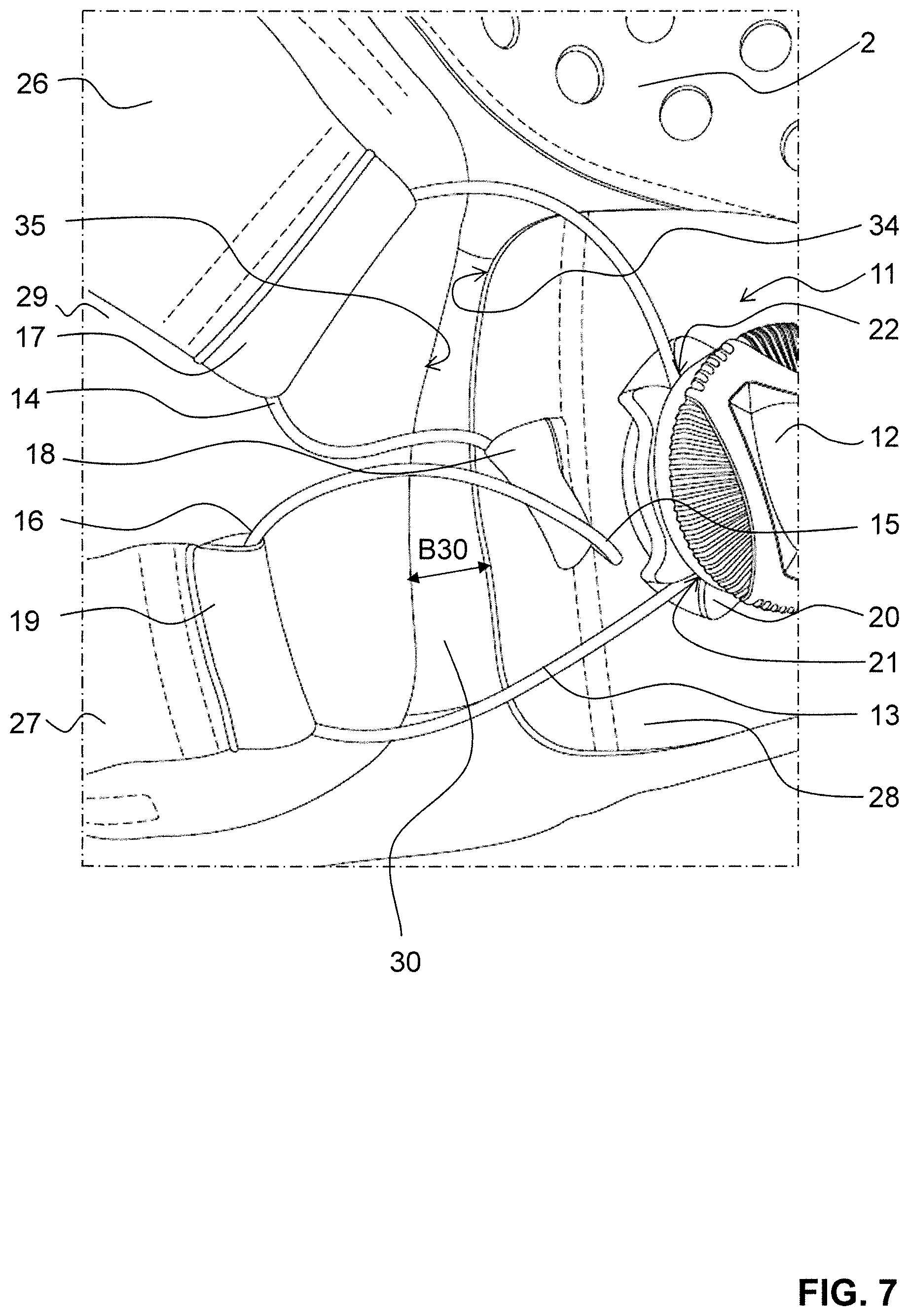 Patent US12137760 Figure 7 – Glove with lacing system