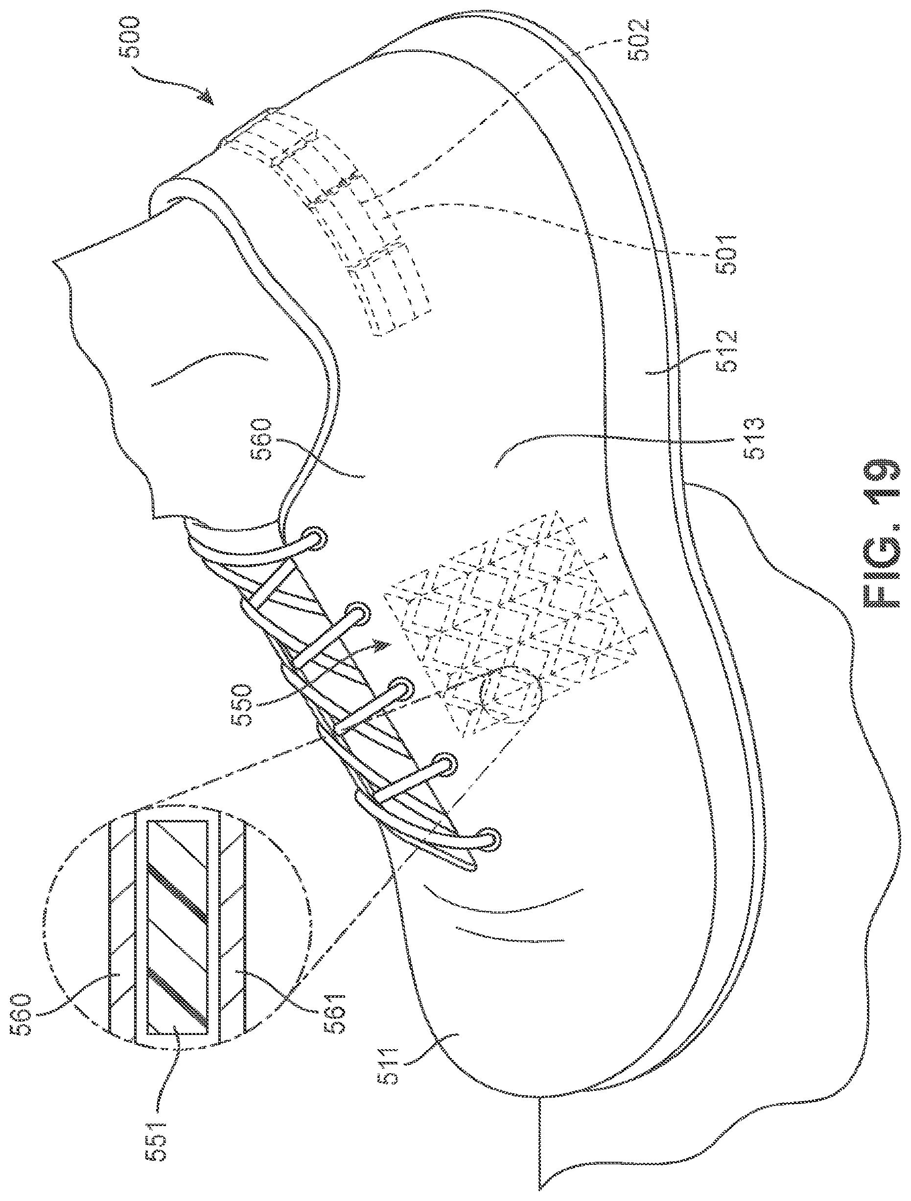 Patent US12137771 Figure 14 – Article of footwear with dynamic support