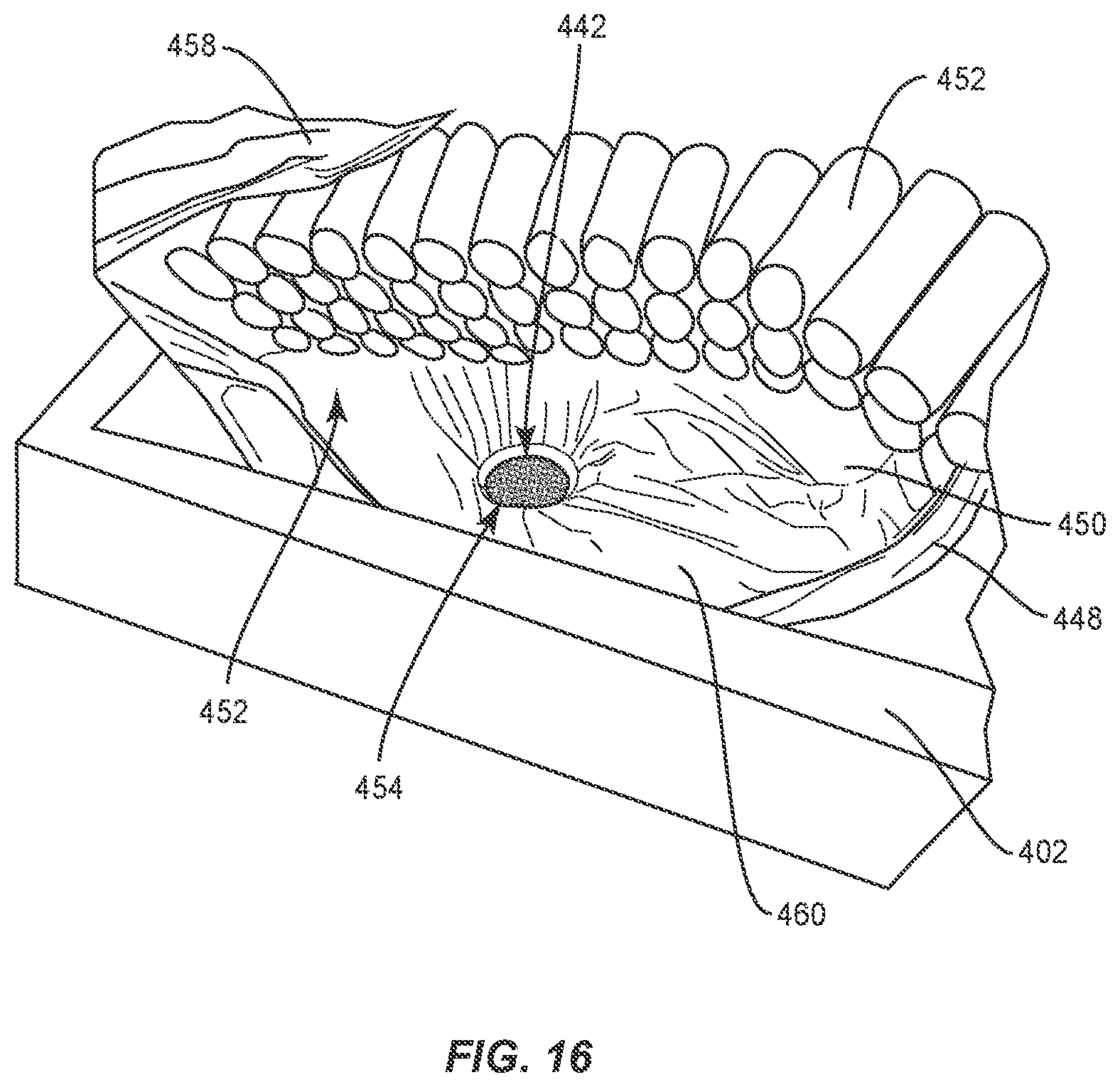 Patent US12137810 Figure 14 – Bedding system, kit and method