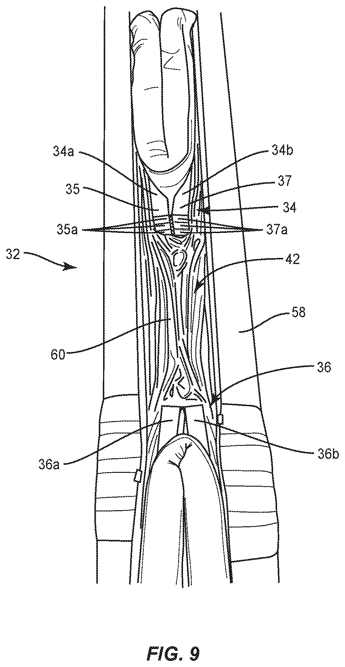 Patent US12137812 Figure 9 – Mattress assembly and method