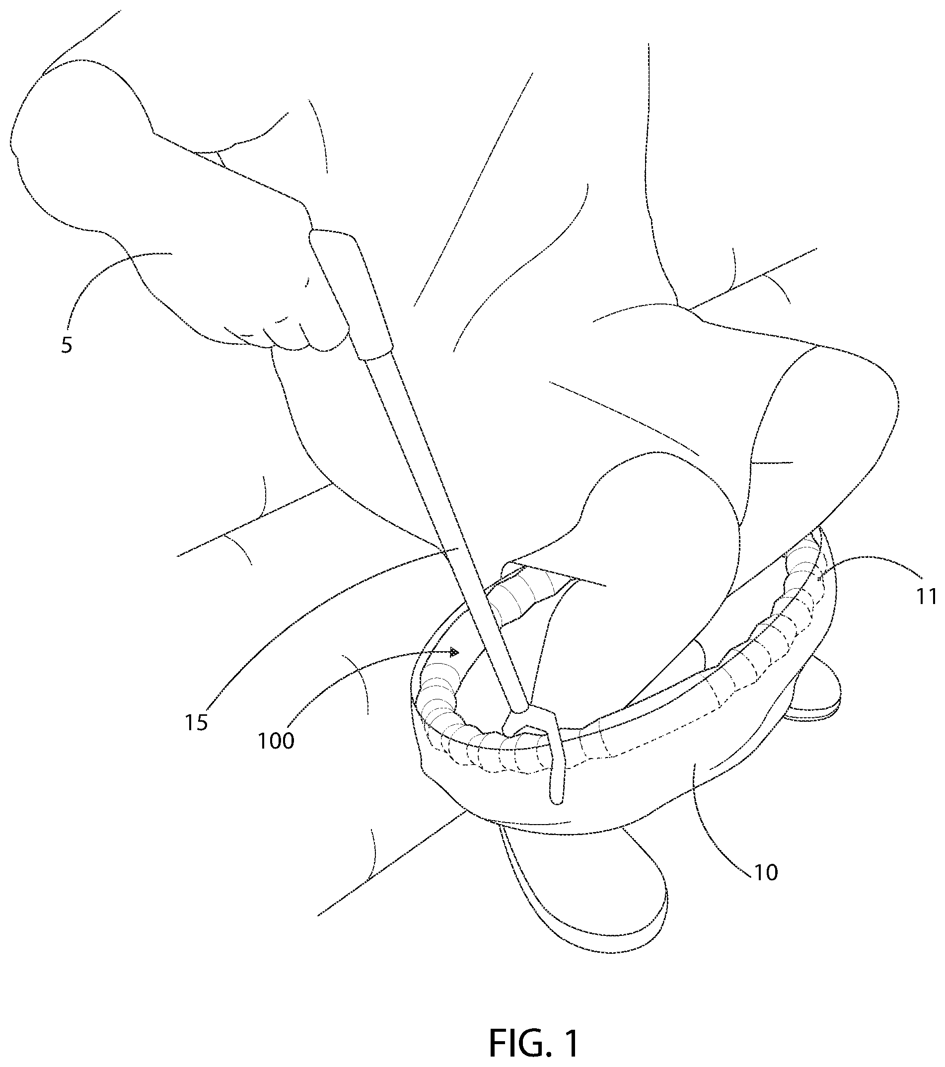 Patent US12137825 Figure 1 – Underwear donning device, system and method