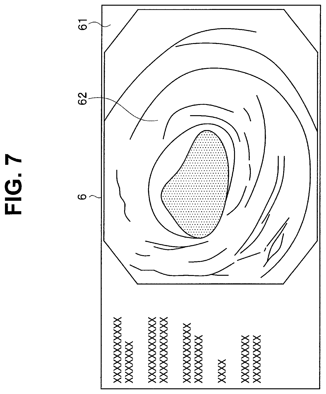 Patent US12137869 Figure 7 – Image processing apparatus, endoscope system, and image processing method